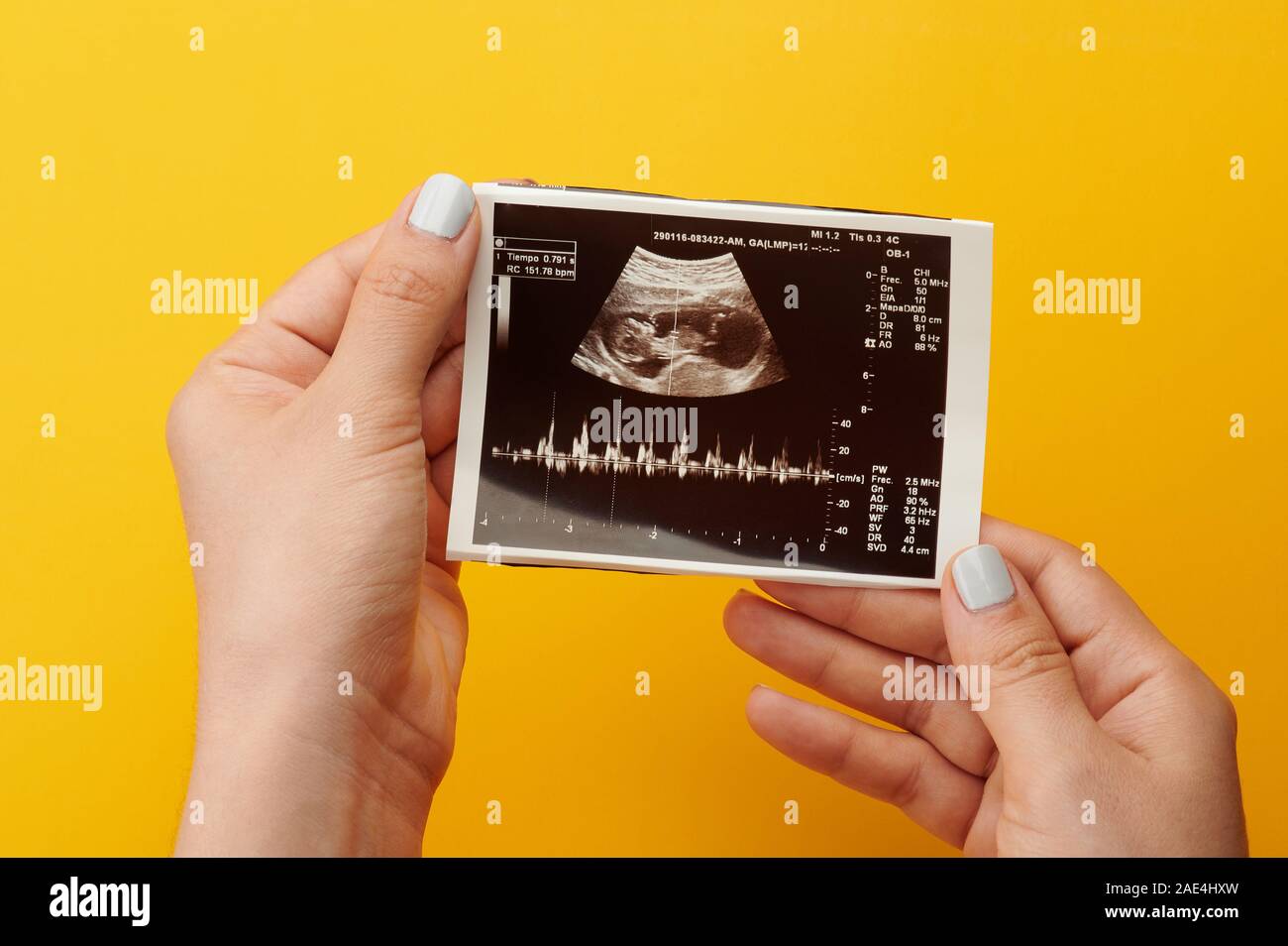 Ultrasuoni foto medico in mani donna vista ravvicinata Foto Stock