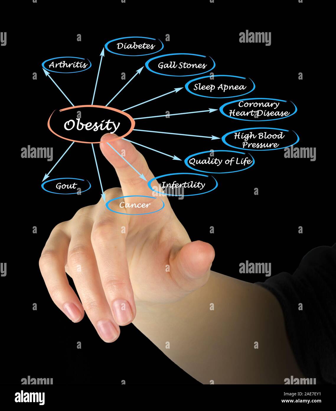 Schema di obesità Foto Stock