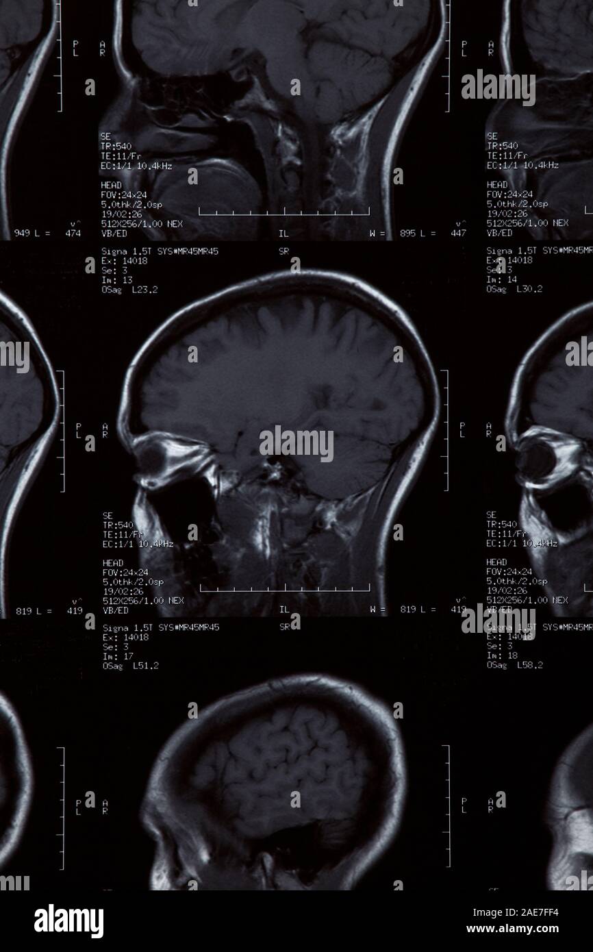 MRI scan close up Foto Stock