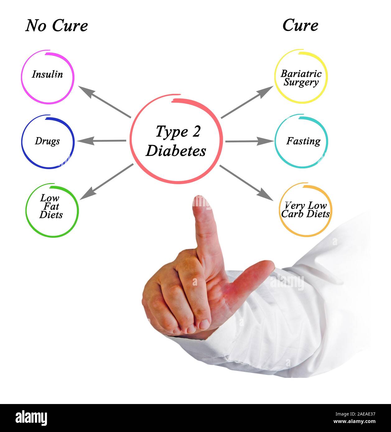 Diabete di tipo 2 Foto Stock