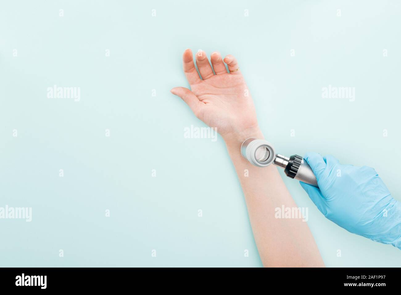 Vista ritagliata di dottore esaminando la mano di donna con dermatoscope isolato su blu Foto Stock
