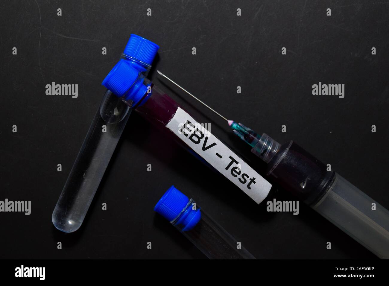 EBV - Test con il campione di sangue. Vista superiore isolata sulla scrivania in ufficio. Assistenza sanitaria/concetto medico Foto Stock
