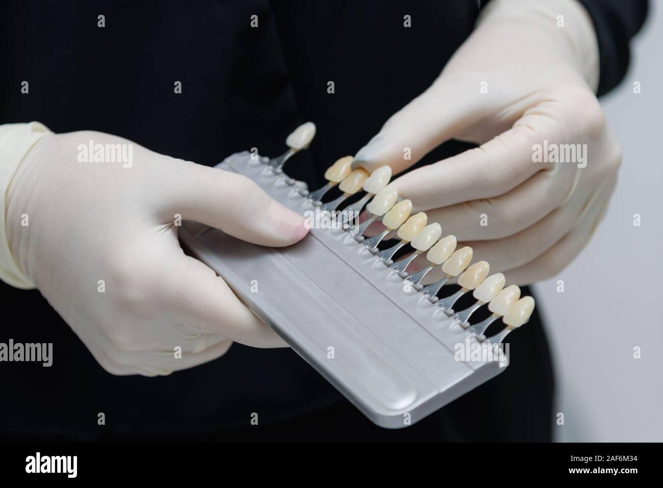 Il medico ha in mano le prove per i denti del paziente prima di sbianca Foto Stock