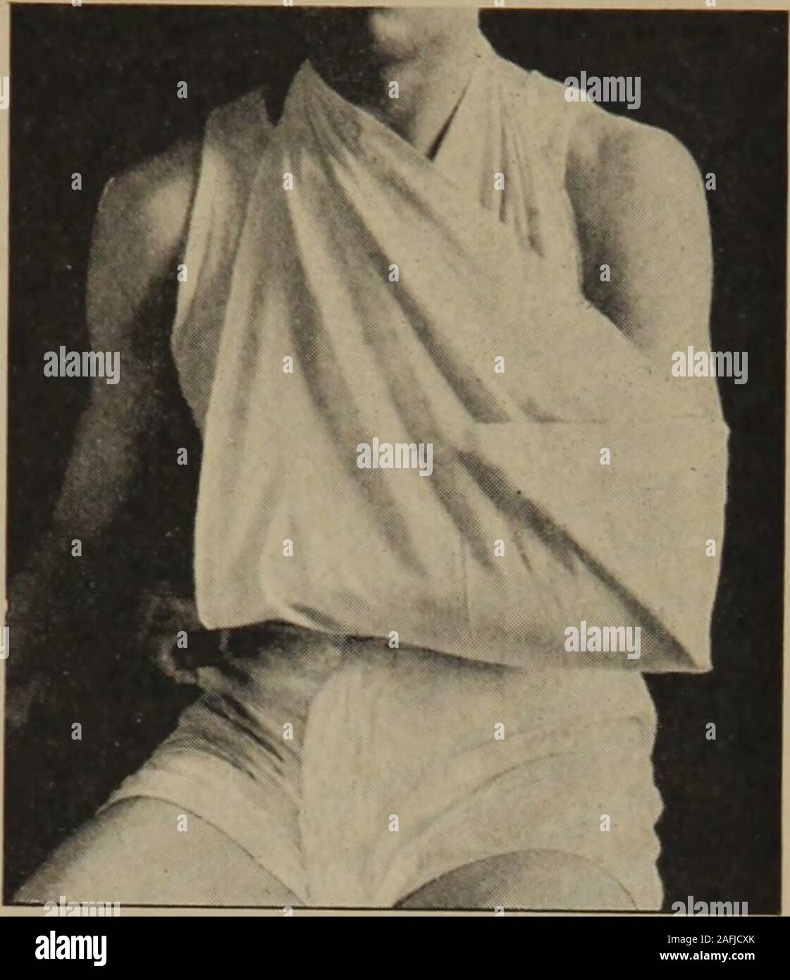 . Igiene personale e Attività infermieristica a domicilio : un testo pratico per le ragazze e le donne per la casa e per l'uso scolastico. con-veniently viene utilizzato quando è necessario tenere medicazioni sul posto.Come una regola è fatta di stout greggi mussola, ma qualsiasi strongmaterial farà; mussola da fogli o capi di abbigliamento o una grande mano-fazzoletto, possono essere utilizzati. Il bendaggio può essere ripiegato in un wideor una stretta striscia, oppure può essere utilizzato in forma triangolare. Dimensioni Theusual per un bendaggio triangolare è il triangolare di metà di un materiale yardof, ma a volte, in caso di emergenza un pezzo come grandi asthis non può essere ottenuto. Ci sono alcune regole fo Foto Stock