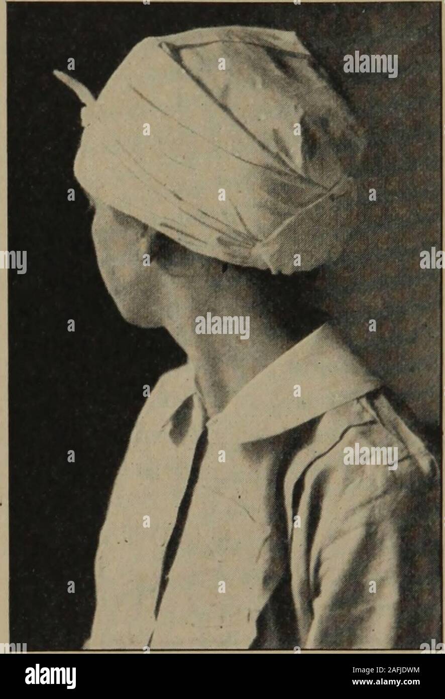 . Igiene personale e Attività infermieristica a domicilio : un testo pratico per le ragazze e le donne per la casa e per l'uso scolastico. aumenta thesuffering del paziente butinterfere con recupero, oreven risultato in permanentinjury. Dislocazioni. Un disloca-zione può essere riconosciuto dail aspetto del giunto.Se non vi è alcun dubbio circa la Fig. 70. Il bendaggio triangolare sulla jjg^^j il suo buon aspetto, com- pare con il giunto su altri lati. A volte la testa dell'omero (osso di braccio) puòessere sentivo di essere fuori dalla presa di corrente. Il dolore nel giunto e perdita di free-dom di movimento sono indicazioni di lussazione. In alcuni personsa d Foto Stock