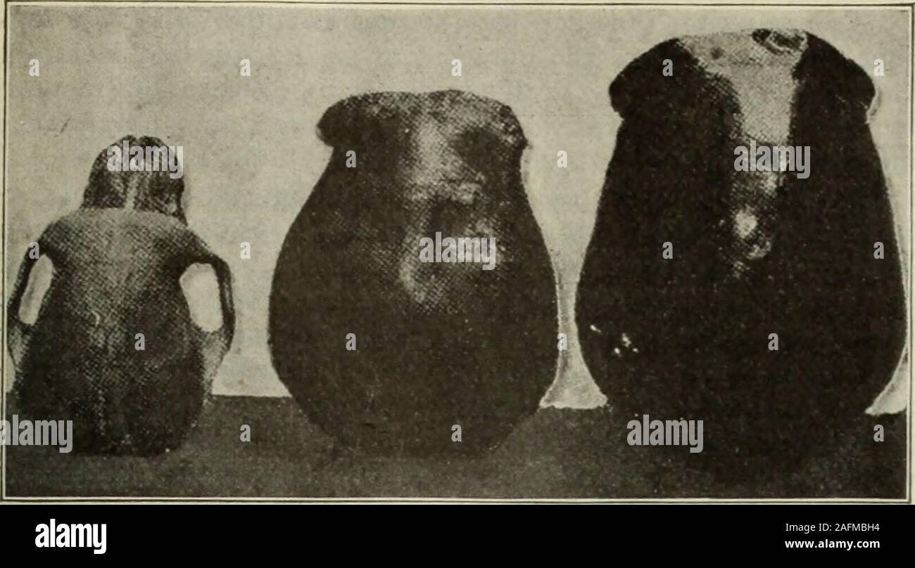 . Il literary digest. -Corpo e sono senza interesse in un caso in cui le prove isentirely anatomico. Ci soffermeremo in particolare sulla teschi. Il punto principale delle differenze, come evidenziato da M. Cligny,sono la faccia di spicco e piccolo cranio di scimmia come com-pared con mans faccia minore e maggiore di cranio. Questi punti arebrought fuori mediante misure di angoli del viso (vedi figg. *** I3) e della capacità cranica. Nonostante questi grandi differiscono-meeting, gli scienziati non sono ancora oggetto di contesa non solo su Java skullnow sotto esame, ma su altri. M. Cligny usparticular ricorda Foto Stock