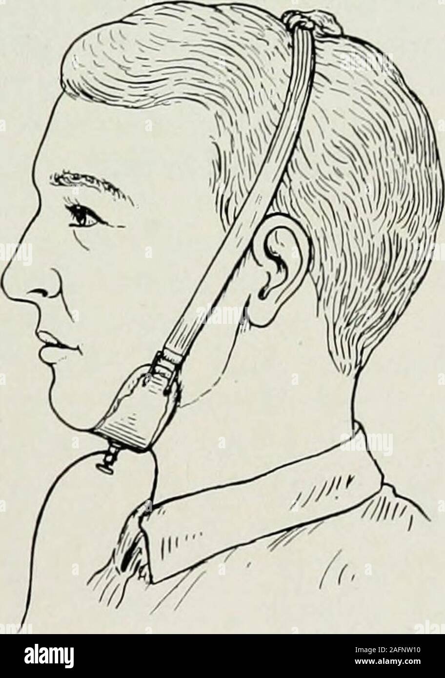 . Dental elettro-terapeutici. Fig. 45.-lato elettrodo. Un altra forma di elettrodo indifferente abbastanza bene adaptedfor farmaco ionico è costituito da una lega di nichel-metallo placcato handlewhich il paziente afferra. Questo dovrebbe avere un moistenedsponge in corrispondenza della estremità aperta e dovrebbe essere coperta con le stock-inette o un panno inumidito con acqua e sale. Essa dovrebbe nonessere di ottone o rame come talvolta realizzati, e dovrebbe essere di elettrodi 109 il più grande dimensione visualizzata dai costruttori. Questa forma di electrodeis preferita da alcuni pazienti, come sembrano simili a holdon a qualcosa; l'epidermide del palmo della mano e isthick Foto Stock