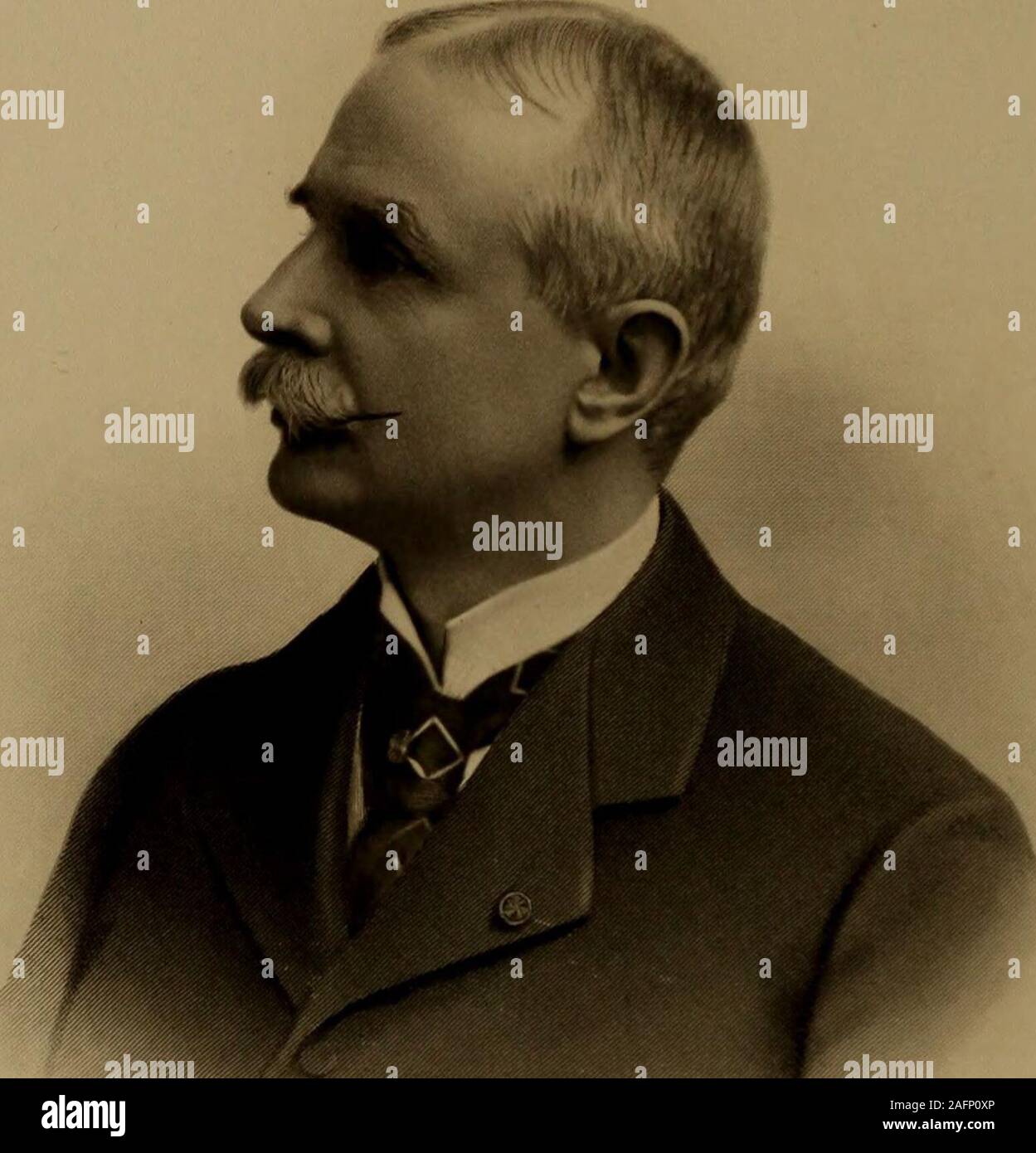 . Un gruppo di illustri medici e chirurghi di Chicago; una raccolta di biografie di molti eminenti rappresentanti, del passato e del presente, della professione medica di Chicago. di acido urico diatesi.Id., 1899; un caso di cronica nefrite tubarica, International cliniche, Jan-uary, 1892; Trattamento di Phthisis Pulmonalis, Id., Vol. II, terza serie,1893; l'uso di trementina in febbre tifoide. Id.. Vol. III. ThirdSeries, 1893; paralisi agitans. Id., Vol. 1Y. Seconda serie, 1893: AcuteTubal la nefrite cronica, nefrite tubarica. Amiloide malattie dei reni,Interstit cronica Foto Stock