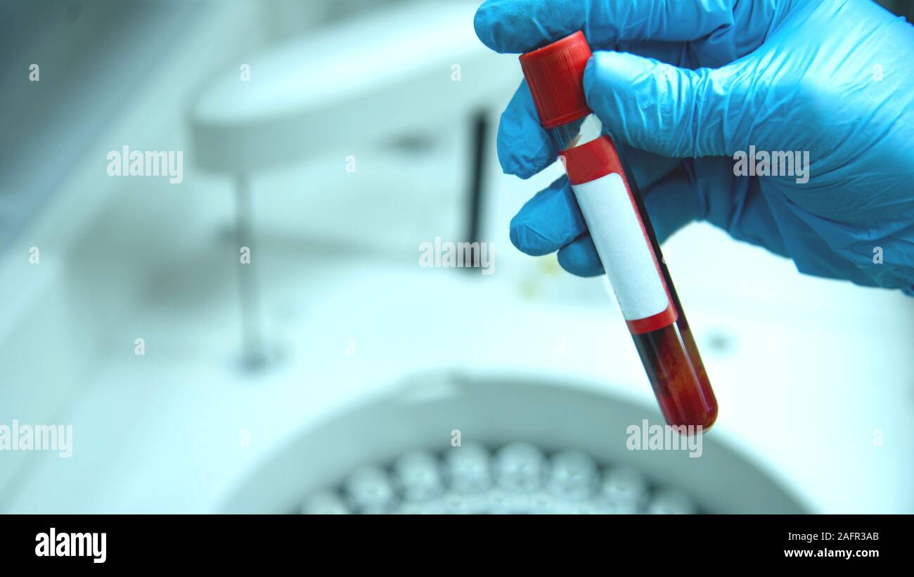 Il tecnico immissione provette per prelievo ematico nella centrifuga da laboratorio Foto Stock