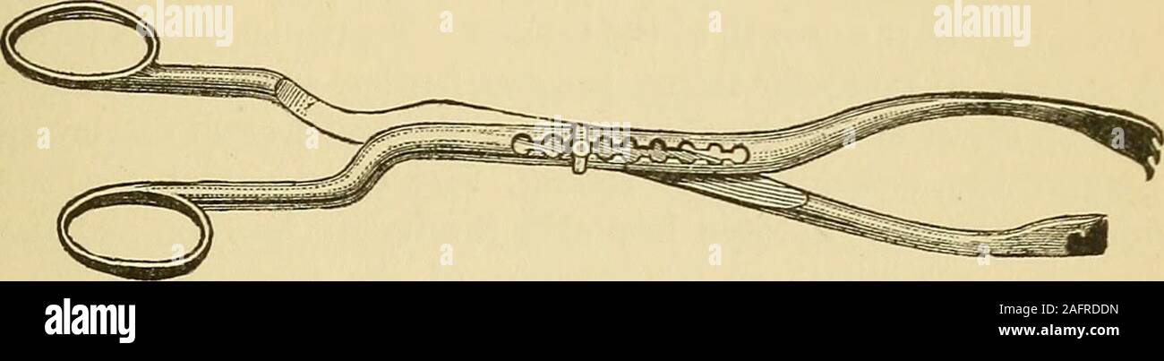 . Encyclopaedia - Wikizionario di ostetricia e ginecologia. erution. Tale indicazione è tuttavia riscontrato nelle seguenti:Kapid crescita del tumore, una dimensione che conduce a disturbi della respirazione circulationand; asciti, origine dell'growths nel vero pelvi, conducono i sintomi di incarcerazione; Violenti dolori (specialmente Avhen essi sufficeto inabilita il paziente per lavoro), e infine le emorragie che nonsono per essere controllato da altre misure. Tra le più rare indicazioni per interferenza chirurgica ci sarà findpregnancy e i cambiamenti che si verificano nel tumore come una cancrena, ecc.Tn tutti i casi la condizione Foto Stock