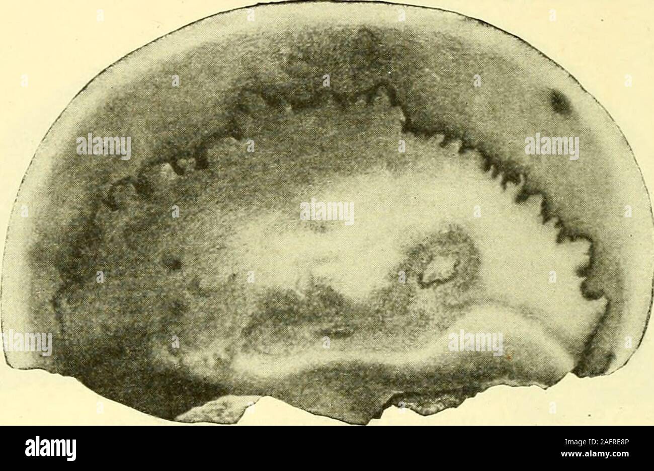 . La corte aperta. durante la vita. Alcuni dei fori thelittle può essere sicuramente identificato come passaggi di vasi sanguigni, e nessuno di loro sembra tobe causato da una malattia, i86 La corte aperta. nel momento in cui l'umanità aveva appena salito in esistenza. L'Egisheim skullsof, del Brux e di Cannstatt tutte caratterizzate da un ap-proach al tipo di ape, e due scheletri scoperto da Messrs.Froipont e Lhoest nel 1897 vicino a Spy, Belgio, appartengono anche a arace che non era molto distante dall'uomo di Neanderthal. Thecave in cui questi ultimi sono stati trovati contiene nella deriva la selce im-plements del crudest tipo e Foto Stock