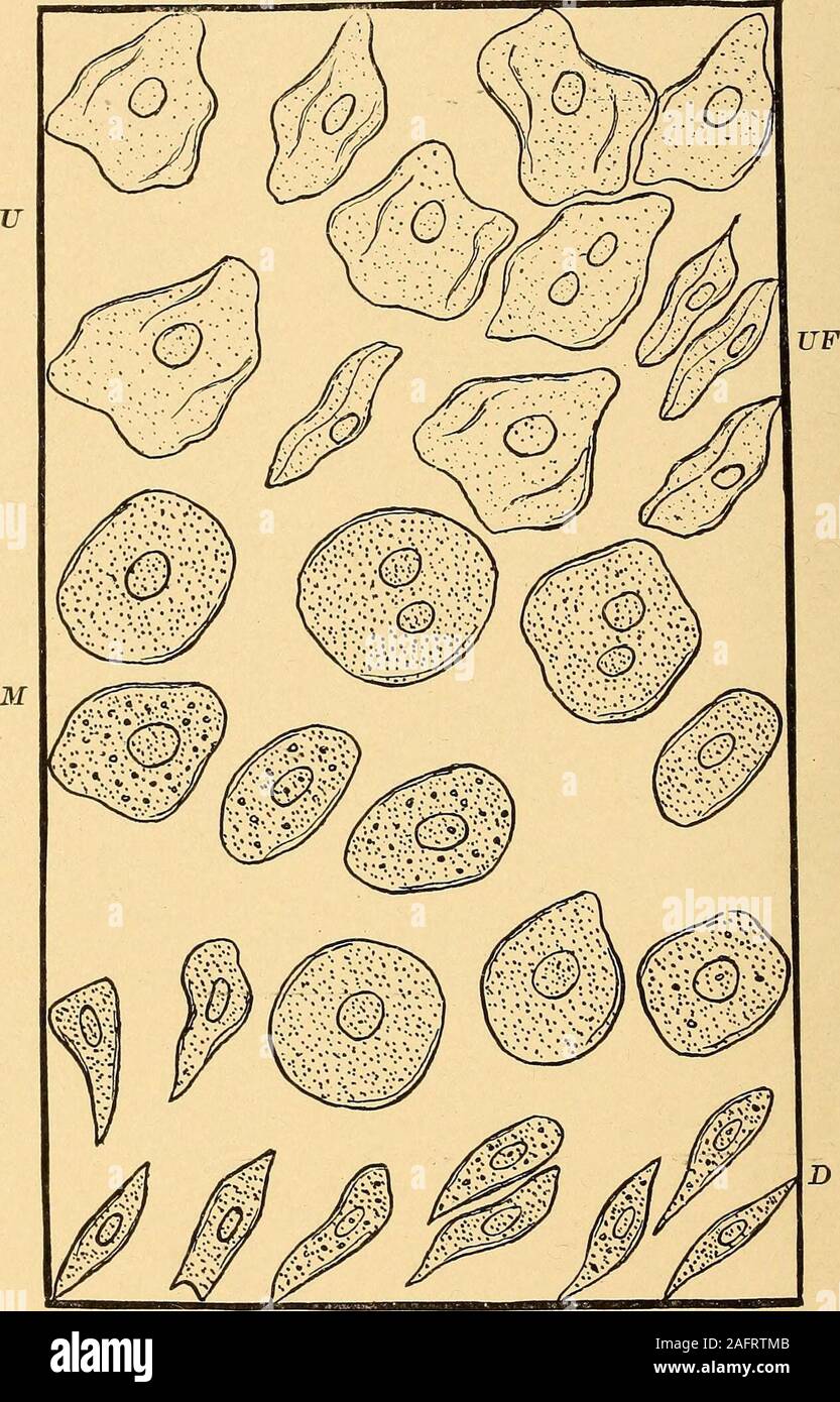 . Analisi delle vie urinarie e la diagnosi da microscopiche e l'esame chimico. SCALETTA, il pelves dei reni, gli ureteri,e i tubuli uriniferous dei reni. L'epitelio uretrale arealso lo stesso in entrambi i sessi, ma sono più comuni nel maschio. Gli epiteli dalla vescica (vedere Fig. 50).-gli epiteli dal blad-der sono di tre varietà distinte e sono facilmente riconoscibili; questi areflat epiteli da parte degli strati superiori, cuboidali da strati intermedi, andcolumnar dallo strato più profondo. Gli epiteli piatta può essere visto sia vista di fronte e di lato, quando essi possono apparire più o meno f Foto Stock