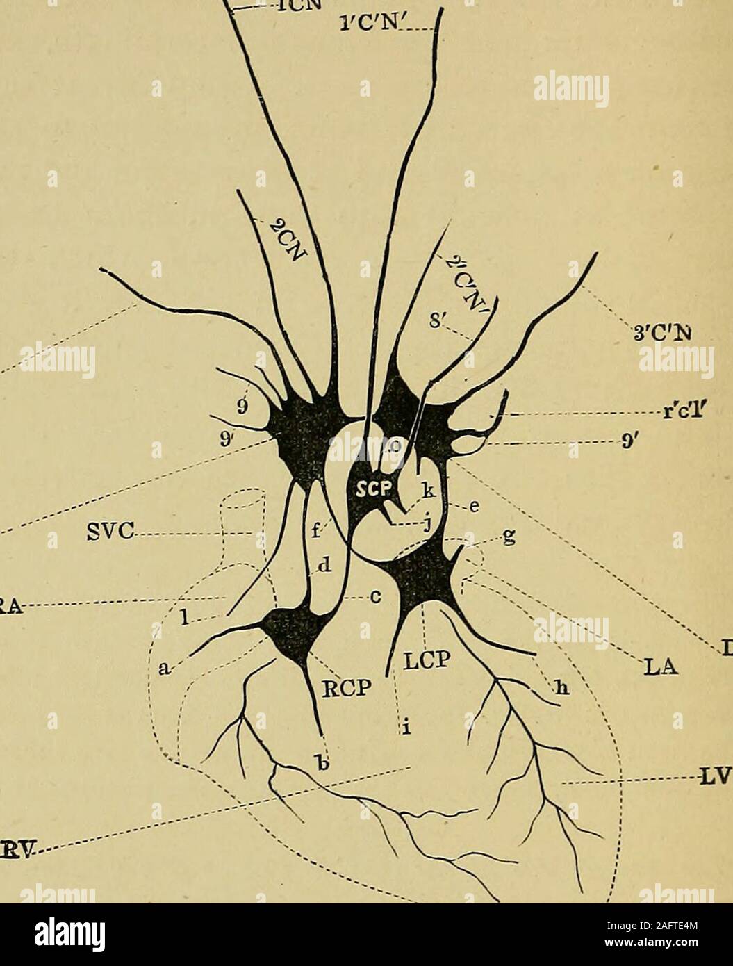 . Le malattie del cuore e aorta toracica. montuosa situata dietro l'arco dell'aorta,tra di esso e la trachea e sopra la biforcazione del pulmonaryartery.^ In essa, di tutti i rami del simpatico e pneumogastric pro-ceeding al cuore, ad eccezione del primo o superficiale ramo cardiaco dei leviti simpatico e la cervicale inferiore il ramo di sinistra pneumo-gastrico,tenninate. La profonda plesso cardiaco è descritto come costituito da due metà(a destra e a sinistra). Il diritto halfij) C P) invia rami- (mi). La coronaria destra plexus (d). (2.) il padiglione auricolare destro (1). (3.) la coronaria sinistra plexu Foto Stock