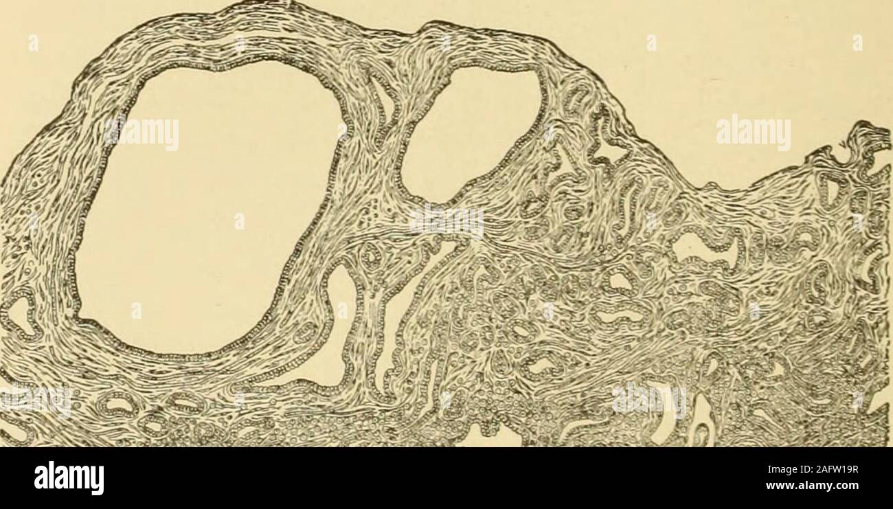 Vassoio Reniforme In Acciaio Inox – 3 Pezzi, Design Antigoccia E Bordo Alto – Per Cliniche, Ospedali E Laboratori