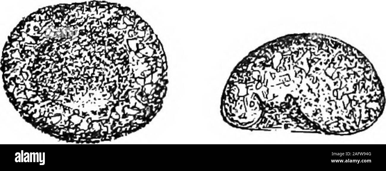 . Il Britannico Rhizopoda acqua dolce e Heliozoa. dy o fangoso pai^ticles, causingopacity; bocca obliquamente invaginated, la sua outermargin ampiamente arrotondati, l'orifizio (terminante theinverted collo) eccentrico e generalmente invisibili. Vista interna del contorno del test è quasi hemispher-ical, essendo più ampio alle estremità posteriore. Associatia questo aspetto ha qualche somiglianza-aiutato da sullasuperficie-iscrizioni-per alcune forme di Biflugia arcula,dal quale tuttavia il carattere di bocca eil invertito al collo una volta che la contraddistinguono. Dimensioni: diametro in faccia vista circa 100 fx.(120-135/^, Penard). Ho Foto Stock