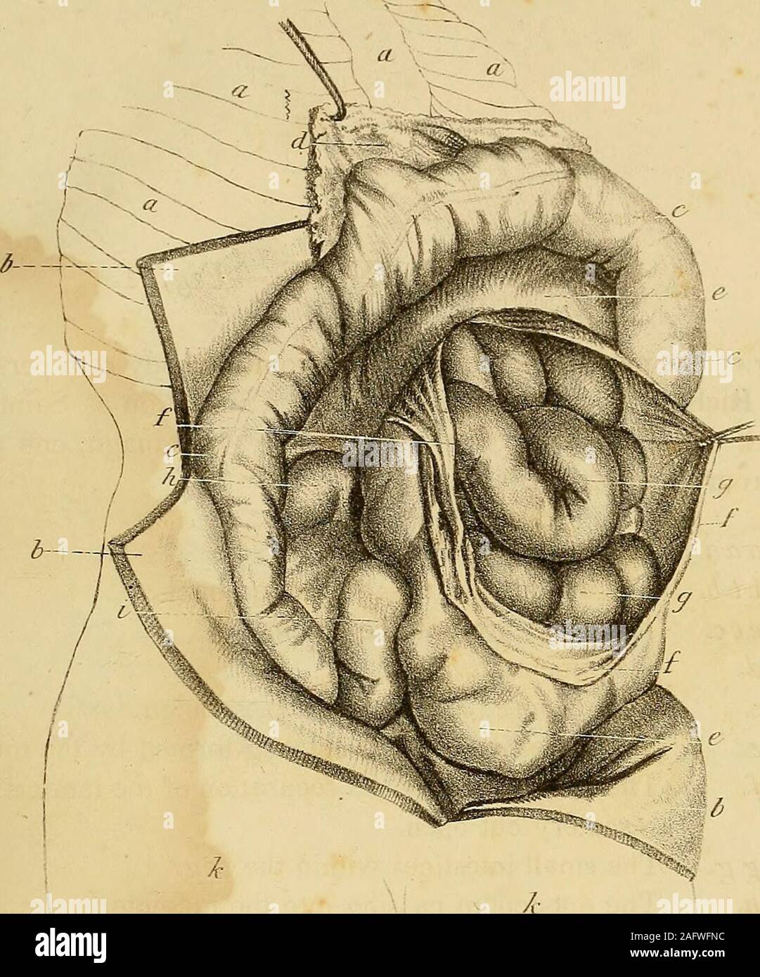 . L'anatomia e il trattamento chirurgico di ernia addominale. n. c. Il piccolo intestino. d. Il colon, di dimensioni molto più ridotte rispetto a quelle usuali. e. Il polmone sinistro, molto diminuita mediante la pressione del pro- truded parti. /. Il cuore. g. La strangolata omento. h. Il colon strangolata. i. Un bougie introdotto sotto il colon strangolata e omen-tum. Piastra XXV.-la Fig. 1. Vista dell'ernia mesenterica preso dal corpo di una persona openedby Sig. Richard Pugh, e conservato nella collezione presso Saint ThomassHospital. Il disegno è stato realizzato dal sig. Kavanagh, uno dei nostri stu-ammaccature, dal recente oggetto. a a a. La s Foto Stock