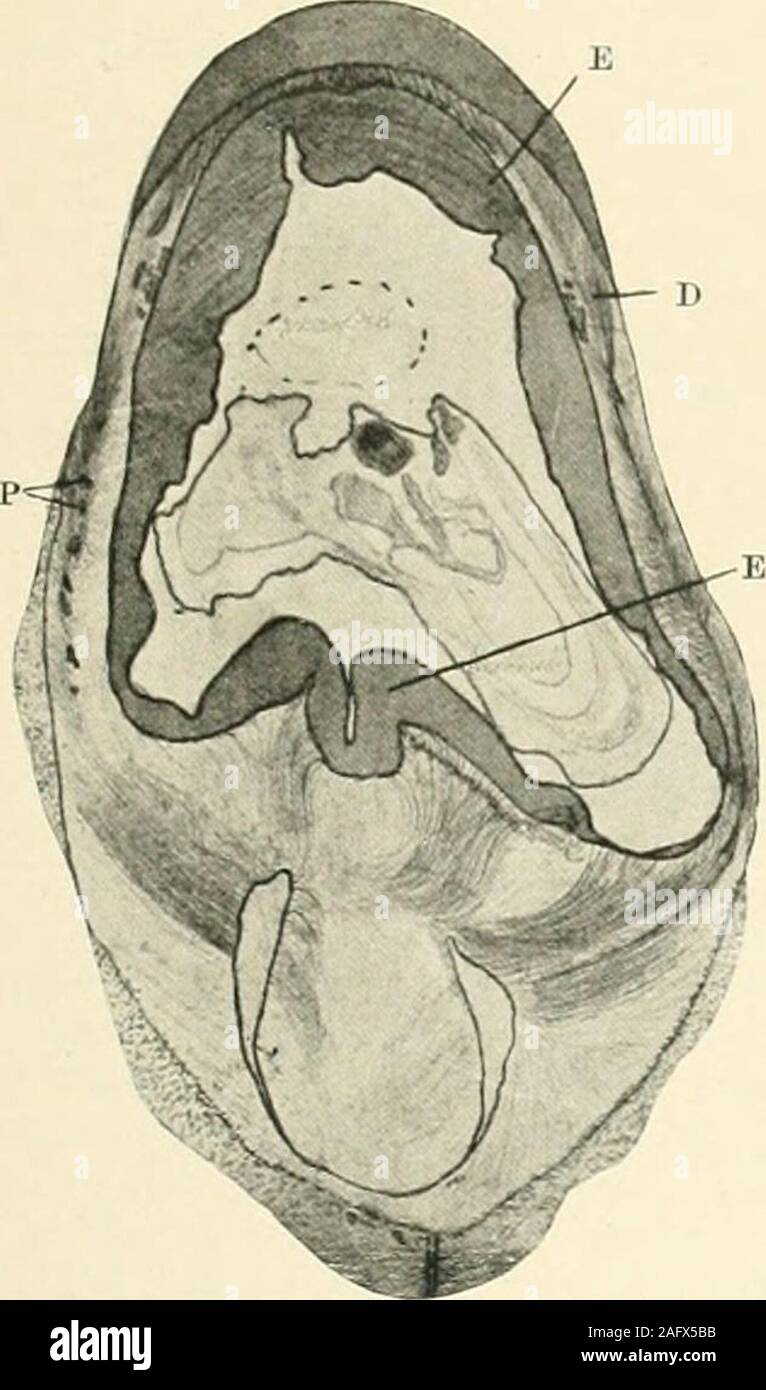 . La scienza e la pratica della chirurgia dentale. Fig. 989. - Dilatata namitumo composiU (radicularodontome delle classificazioni più vecchi). Campione di inpossession J. G. Turner, che non ha alcuna storia del caso. La corona è ben sviluppato e appearsto essere quella di un molare mandibolare; il radicularportion presenta una massa calcificata, con un hollowat base apparentemente riempita parzialmente dal tessuto secondarycalcified. Il distacco del odontome è indicato casi più intima. III.-TESSUTO CONNETTIVO ODONTOMES Questo gruppo comprende quei odontomes thatarise solo dai tessuti dentali di meso-origine dermici. La classifi Foto Stock