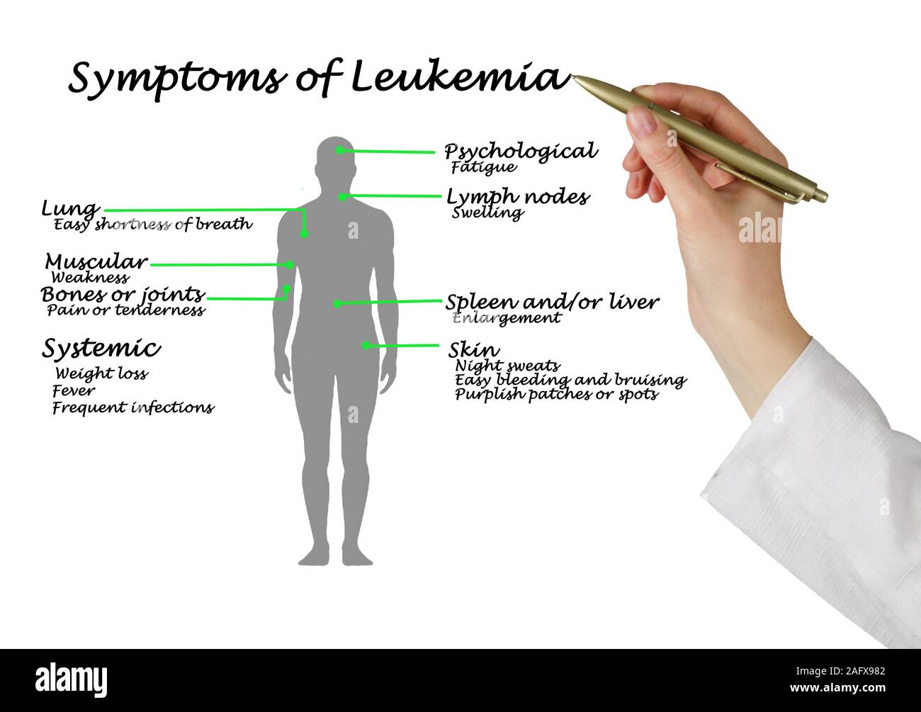 I sintomi più comuni della leucemia Foto Stock