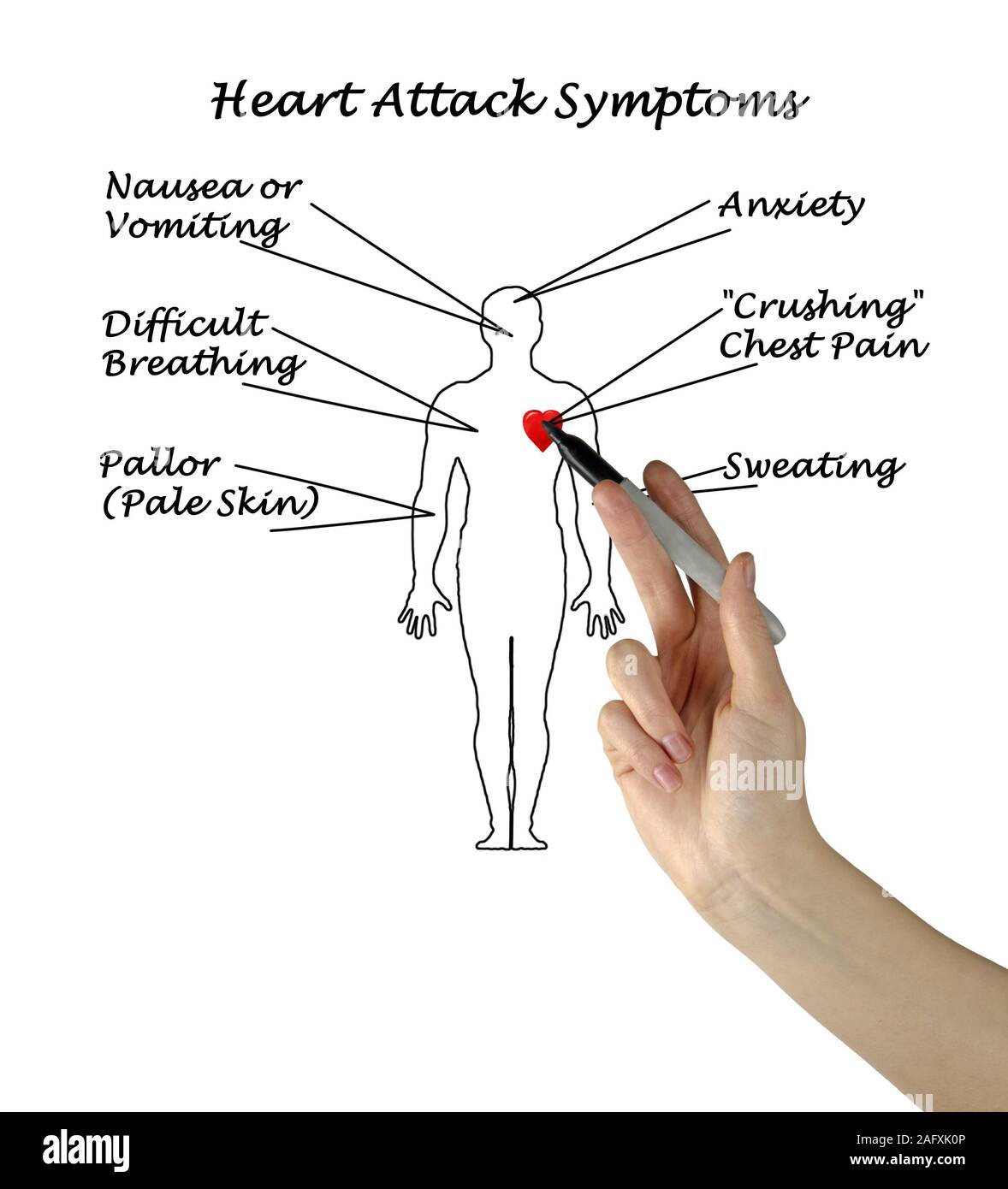 Attacco di cuore i sintomi Foto Stock
