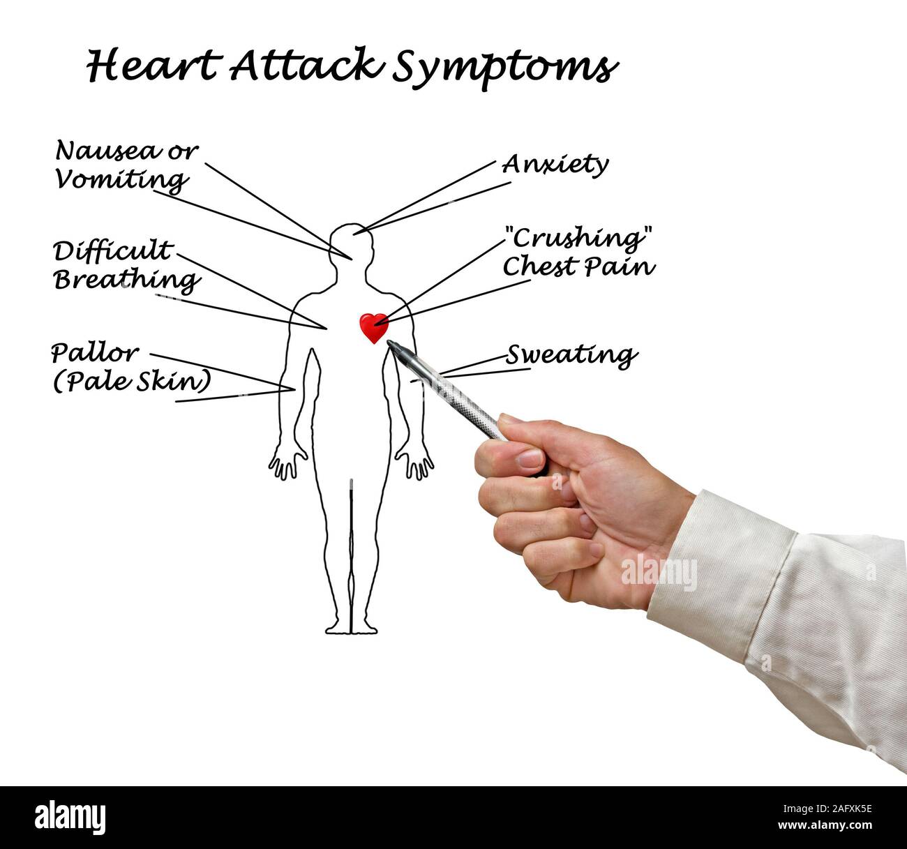 Attacco di cuore i sintomi Foto Stock