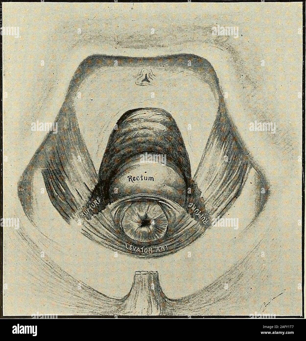 La diagnosi e il trattamento delle malattie delle donne. iately dopo la  consegna di thechild e placenta, la ricerca deve essere fatta per le  lacrime del perineo e pavimento pelvico. Varietà