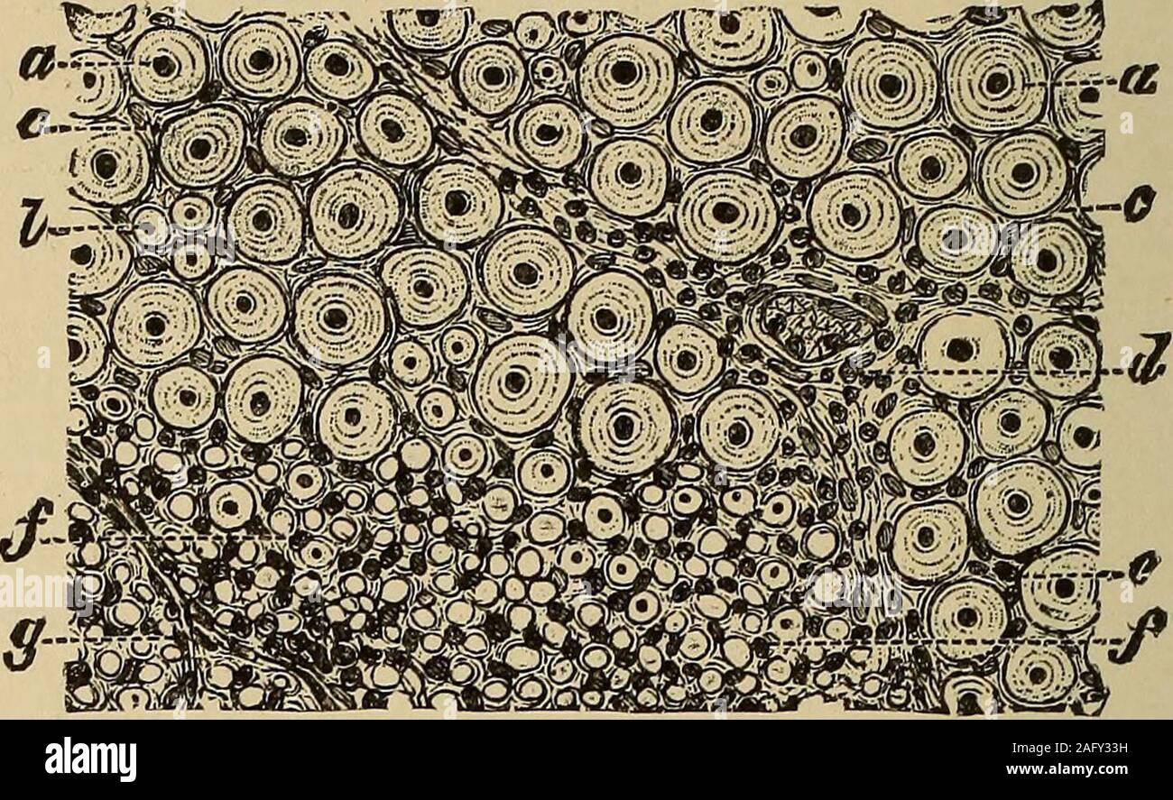 . Un trattato sulle malattie del sistema nervoso dei bambini, per medici e studenti. trala ganglio-cella e theperipheral nervo-asparts in fibra di un neurone. Più di recente, researcheshave mostrato che la samepoison che spesso affectsthe nervo periferico-fibermay occasionalmente ganglio involvethe-cell. Stieglitzhas dimostrato questo per essere thecase in avvelenamento da piombo. Hefound un distinto poliomy-elitis in animali compelledto inalare i sali di piombo. Oppenheim ha descritto lievi variazioni nella spinalcord nei casi di neurite alcolico. Questi ultimi gli investigatori hanno trovato changesin del midollo spinale e dei nervi cranici root Foto Stock