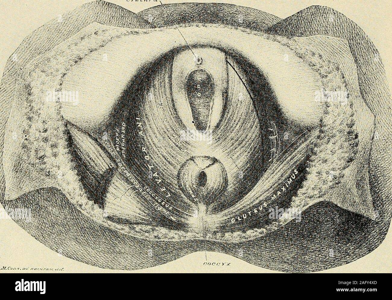 . La diagnosi e il trattamento delle malattie delle donne. Otturatore fascKi,A:iterijr bupcrficia! Perineale jAnal n.l fasciali -^ - - j|ji.-rricial scudo spli Esterni ! Io ho IDorsal nervo della clitorisI 1 1 pudic interno a. Ho 1 - (perineale, n. Ho llnferior hernjrrlioidal a. perineale iTransverse m. Fig. 488. Vista delle strutture superficiali dal di sotto. Il Siiowing Splincter Ani muscolo, tne TransversusFerine! I muscoli e le arterie e nervi. (Deaver-anatomia chirurgica.) 470 lacerazioni e fistola Urfihra. Fig. 489. Le strutture superficiali rimosso, esponendo il levator ani et vaginale i muscoli. (Sav; Foto Stock