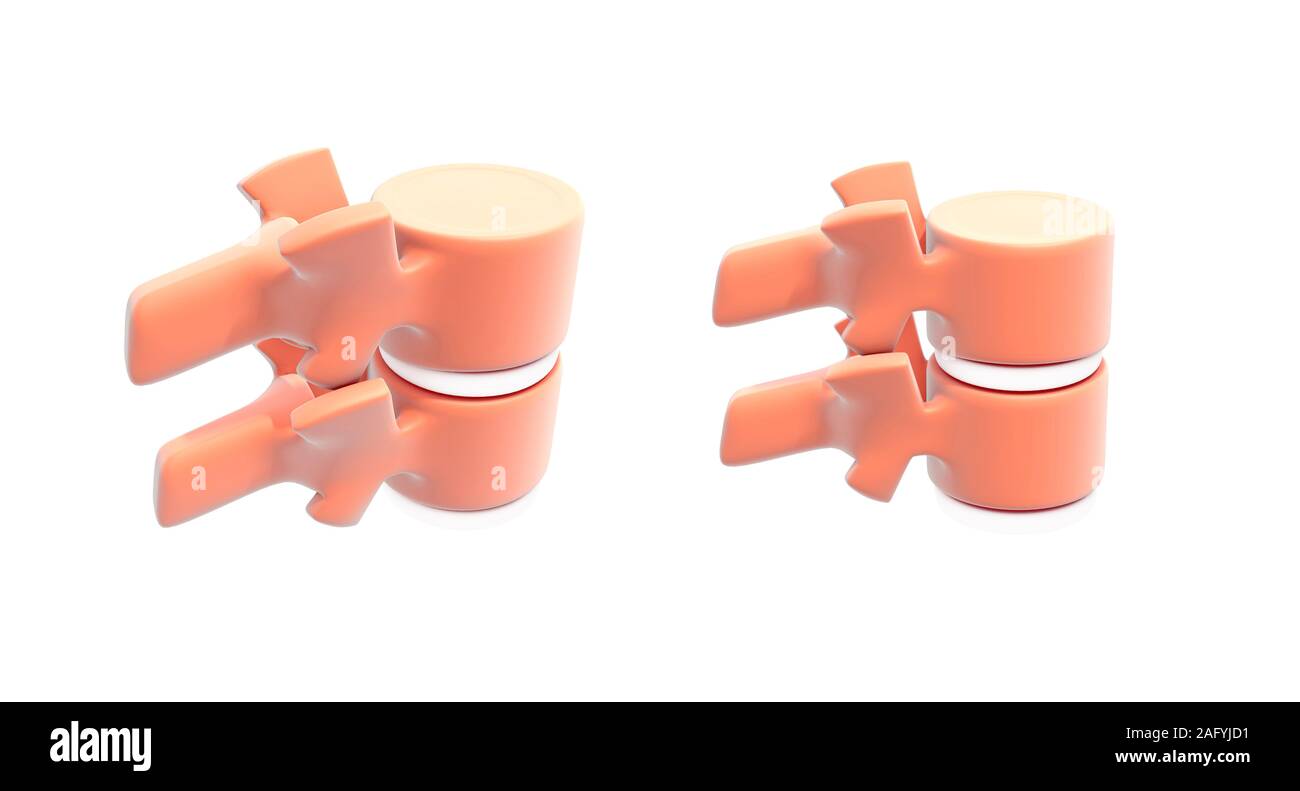 3d illustrazione delle vertebre della colonna vertebrale umana, schematica rappresentazione grafica. Immagine isolata su sfondo bianco. Foto Stock