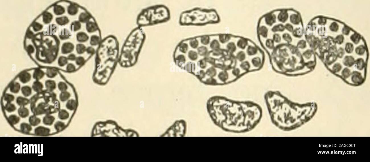 . Il giornale americano di anatomia. Fig. C masse di cellule lutear dai vecchi scaricato follicolo, con interstitialcells giacente nel tessuto connettivo tra masse. (X 950) confronta la figura 9. l&GT;!S-"v ^???y ^<M *WV^^. Fig. D massa di cellule lutear scaricata dal follicolo di gallina, con pigmento par-ticles sviluppato in rete. (X 950) confronta la figura 11 e la figura 20. Corpo luteo nell'ovaia del pollo 9 arancione (1. Le masse di cellule finalmente diventare quasi riempito con materiale thisyellow, alcuni di essa la raccolta in grumi più timeslarger rispetto ai nuclei degenerati. Ulteriori prove di chara Foto Stock