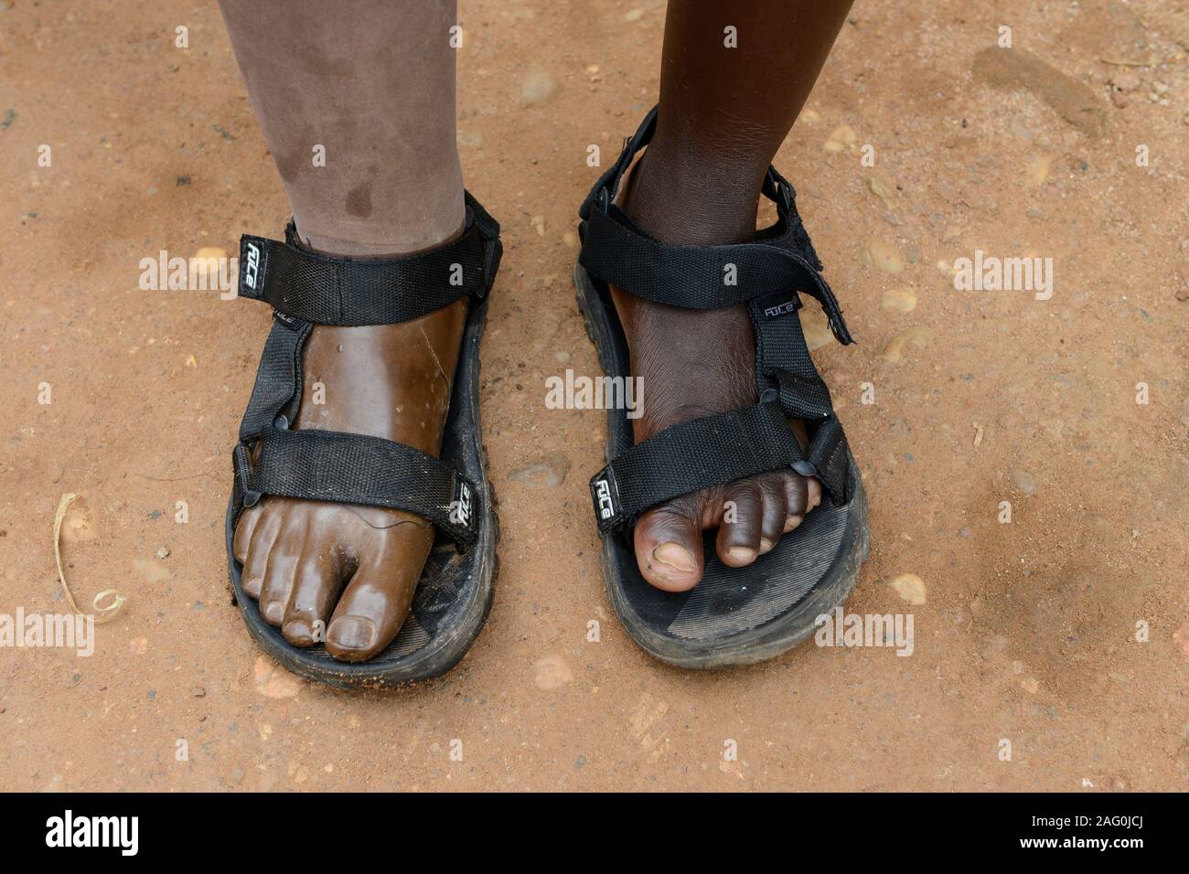 Il Togo, Tohoun, un orfanotrofio, una ragazza con protesi di gamba Foto Stock