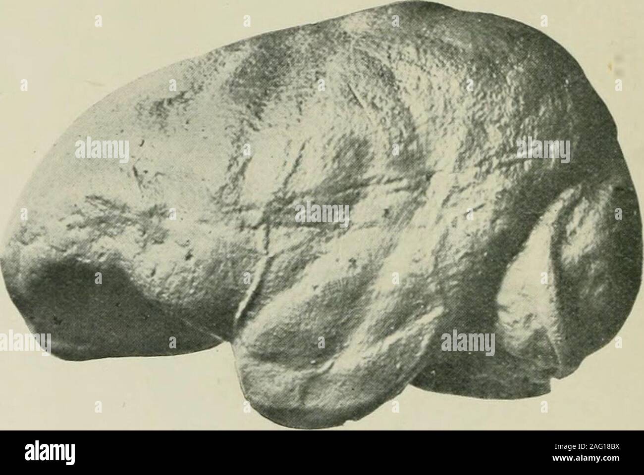 . Ufficiale di anatomia. sider, sur le ruolo morphogene-tique de ce muscolo, Bull, et Mem. Soc. Anthrop. de Paris, 1903. ^ R. Anthony et G. Schwalbe, cit. Nelle sue memorie 1907 Schwalbe ha dimostrato che evenin endocranial umana getta la preminenza delle convoluzioni è visibile sulla superficie della fossa temporalis. * J. Symington, Edimburgo Medical Journal, cit., pp. 98-99. 98 Professor M. Boule e il professor R. Anthony loro endocrauial cerebrale impressioni sono simili a quelli osservati inCarnivores e ungulati. Tutti sono a conoscenza con il professor G. Elliot Smiths^ remarkablestudies sull'en Foto Stock