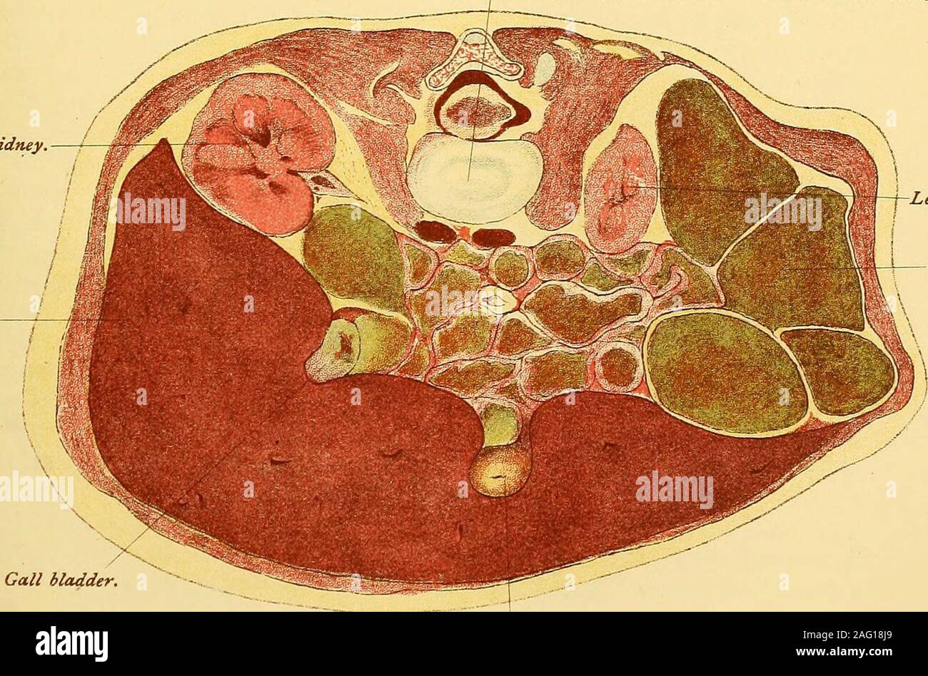 . Manuale di assistenza prenatale patologia e igiene : il feto. estremità pilorica ofStomach rene destro. - Fegato. La cistifellea. Piastra di cartilagine vl tra la seconda e la terza vertebra lutnbar.. Rene sinistro. Il colon. Z ombelicale<ein. Gli organi addominali 113 unite mediante le iliache interne, per quest'ultimo sono a questa età insize piccola in confronto a loro. Quando l'addome del feto è aperto, alcuni eccellenti peculi-arities sono evidenti in una sola volta. Il grande omento è marcatamente trans-genitore e delicati nella tessitura; il fegato è molto grande (piastre IV., V.,VI e VII) e visualizzato ad occupare quasi la metà del Foto Stock