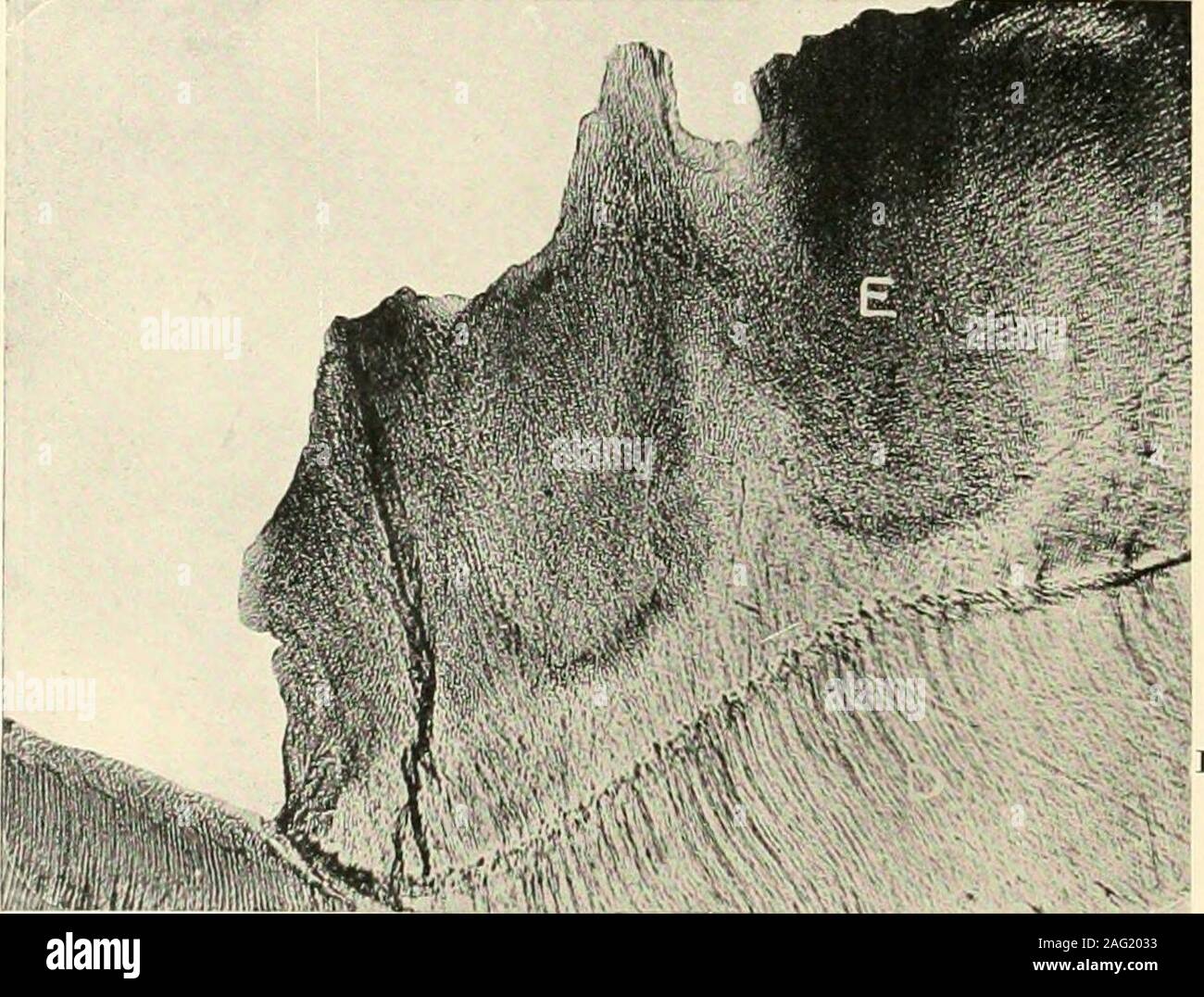 . La scienza e la pratica della chirurgia dentaria. phylococcusbrevis. Una terza categoria comprende il cromo-batteri genica menzionato su una pagina precedente.Di sopra, il Bacillus liquejaciensfluorescens motilis, il Bacillus plexiformis, e Proteus vulgaris sono Gram-negativi, tutti gli altri essendo Gram-positivi. Arrotondare i bordi delle diverse superfici sono trovati 302 molti thread-come i moduli. Questi spesso includesuch organismi come tlie Leptothrix innominata andracemosa, Leptothrix buccalis maxima, il strepto-thrix buccalis e il vibrios descritto come theSpirillum sputugenum e Spirochaete dentium,che Foto Stock