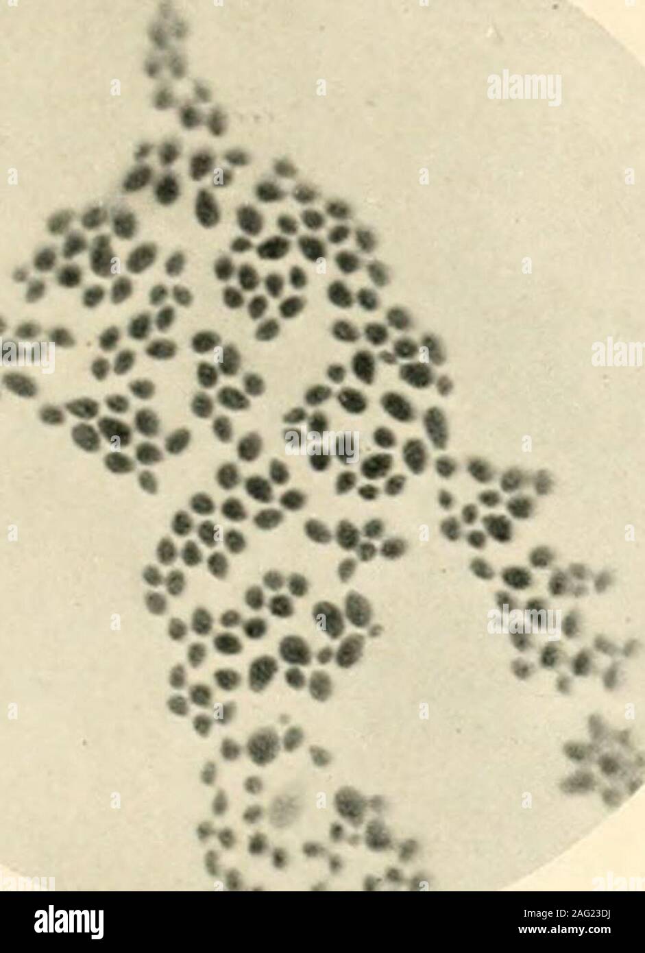 . La scienza e la pratica della chirurgia dentaria. hly forma articolata, closelyresembling il hyphomyces, o stampo funghi.Gli organismi sono tutti relativamente grande, essendo10 /J, o più di diametro ; essi sono di forma circolare, ovale o,lanceolated, e se colorate con poli- 279 cromatica lihie metilene mostra un distinctnucleus nel centro prendendo una colorazione rossa,e suriounded da Ijlue cloplasni in whichare un nuniher finemente refractile granuli. I principali rappresentanti di questo gruppo associ ated-con la patologia della bocca sono thesaccharomycrs albicans, oidio albicans, o cosiddetto tordo fungo, un Foto Stock