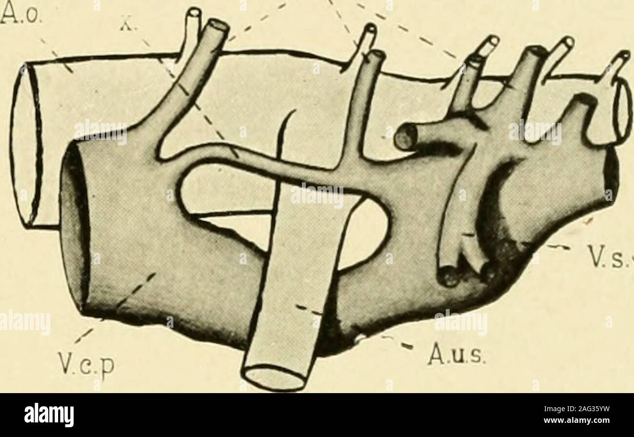 . Il giornale americano di anatomia. sviluppo l'anastomosi viene progressivamente spinto in avanti fino a itreaches la normale posizione caudale appena al lobo posteriore dell'kidneyabout l'undicesimo giorno. Nel frattempo la V. coccygomesenterica hasdeveloped e al giorno 8 è visto come una piccola nave proveniente dalla superficie dorsale del cerva gut. Esso si unisce il anastomosisdirectly o il uno o il altro postcardinal anteriore al procedimento di anastomosi;l)ut in quest' ultimo caso infine unisce l'anastomosi stesso. In adultit comunica direttamente con il portale epatica system (vide Fig. 7,d, V. Foto Stock