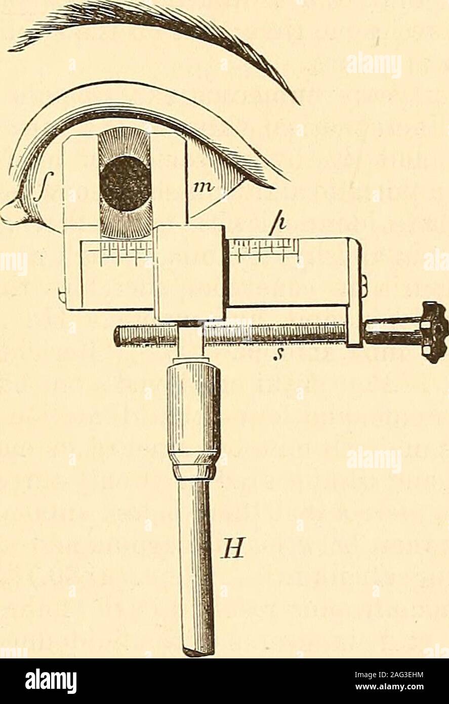 . Un trattato di malattie dell'occhio. dalla figura allegata.Il bordo dell'indice fisso (m) è mantenuto in linea con il bordo interno del thepupil, e poi quello mobile (/) viene progressivamente avvitata fino al suo bordo midriasi. 291 corrisponde esattamente con il bordo esterno della pupilla. L'intervallo trai due indici rappresenta il diametro della pupilla.^-H] Cause.-prima di entrare su diverse cause che possono producemydriasis, sarà ben brevemente a considerare l'azione di taluni substancesupon la condizione della pupilla, sia in aumento o in diminuzione itssize. Certo su Foto Stock