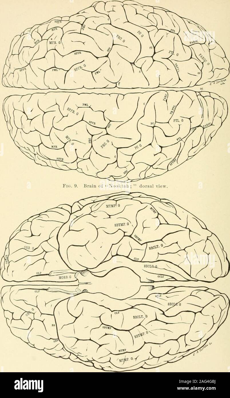 . Il giornale americano di anatomia. doubtas al modo di designare ogni segmento. L'aspetto è uno dei duplica-zione analoga a quella osservata finora Manouvrier e altri. Il paracentral è semplice, spazzamento caudad gradualmente a comparire sulla superficie thedorsal per 12 mm. Cephalad unisce un segmento del supercal-losal. Vi è un indipendente intraparacentral longitudinale. Il inflessa è assente. Sia la rostrale subrostral e fessure sono ben marcato; ex is5.5 cm. di lunghezza, quest'ultimo 3.5 cm. Superficie orbitale.-sulla superficie orbitale, le fessure sono complesse.Vi è un trira laterale Foto Stock