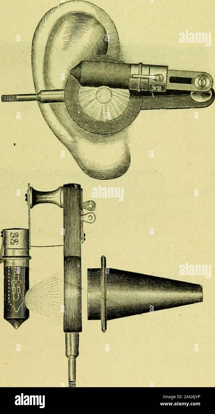 . Medical energia elettrica; un Trattato pratico sulle applicazioni di elettricità a medicina e chirurgia. stelo della maniglia comunica conla secondo terminale.) Lo specchio è mantenuto da uno scorrimento ringin ganasce di bloccaggio formata dividendo l'estremità esterna di thehandle estensione. Questo metodo di organizzazione permitsthe uso di differenti dimensioni degli specchi. La maniglia properis di legno duro, ed è provvisto di una molla, G, whichmakes e interrompe il circuito. In uso il manico è heldbetween il pollice e l'indice, la molla essendo pressedby il secondo dito per completare il circuito. Il disco di gomma di specu Foto Stock