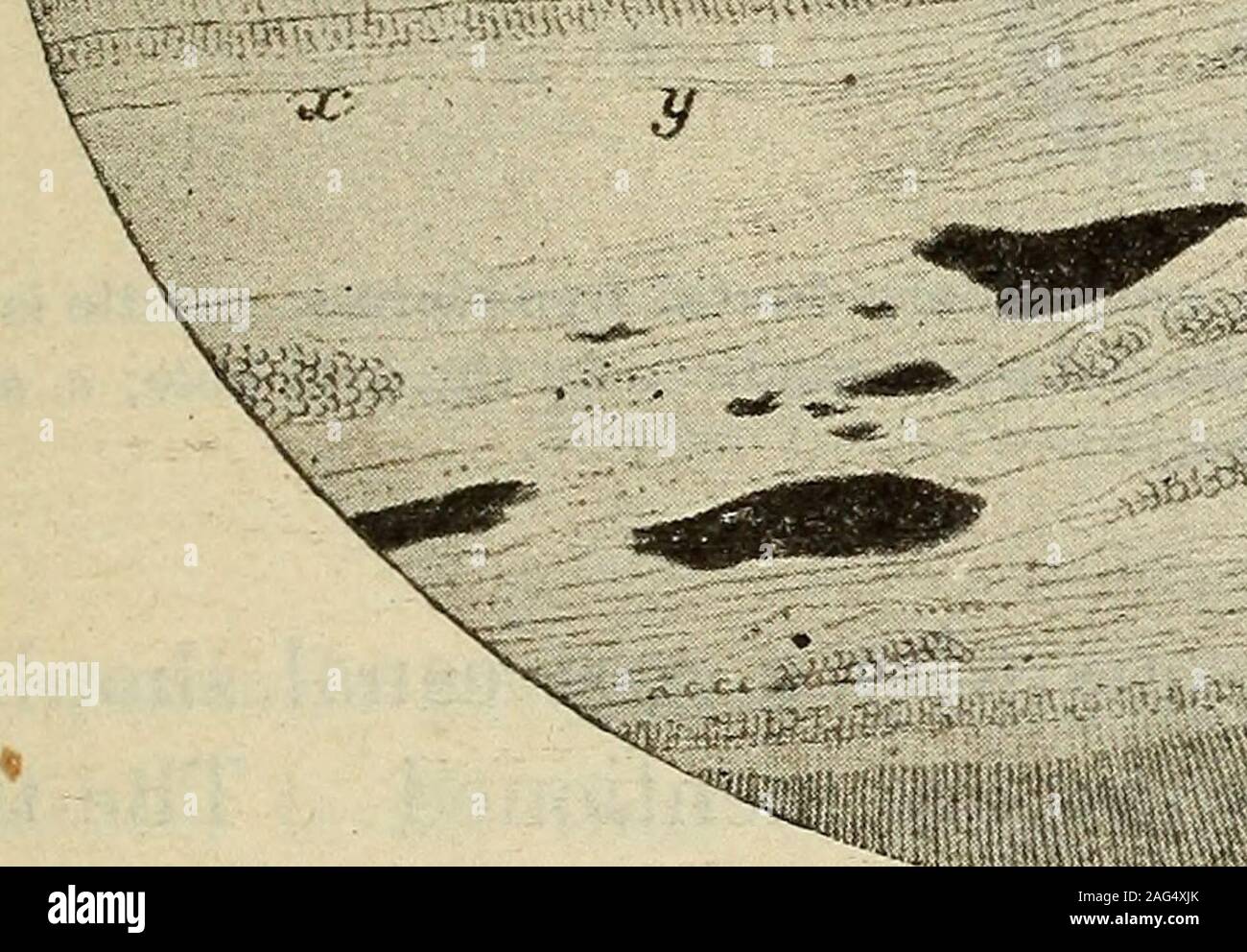 . Dental materia medica e terapeutica; con particolare riferimento all'applicazione razionale di misure correttive per le malattie dentali ... ho y pp^ Figura 97. Sezione IP attraverso la radice di un molare. Mostra irregolare (secondario) alla dentina. (Reich.)C, il cemento; D, D, dentina normale; P, polpa; J D irregolari di dentina in due strati (&lt;x, 6). dentina, come si è osservato al microscopio, frequentemente mostra anirregular massa di tubuli ritorto, che non hanno alcun collegamento conla odontoblasti. Tali dentina, come pure la presenza di pulpnodules, barre meccanicamente l'introduzione forzata di fluidi in posizionedi polpa. 1 Rei Foto Stock