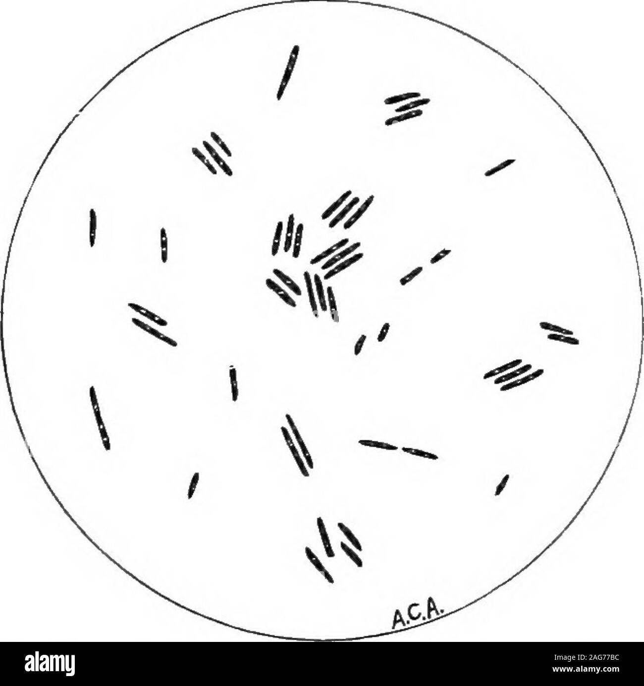. I principi di batteriologia: un manuale pratico per studenti medici e. g. 67.) quando esaminato in colorate prepara-zioni che la sua continuità è segnata da darklyand alternata leggermente le aree macchiate. Di solito è visto come asingle asta, ma possono verificarsi in coppie e meno frequentlyin più filamenti. La domanda di come la sua sporigeni proprietà è stillan aprire uno, anche se il peso di prova è in oppo- per una ulteriore discussione della patologia e della patogenesi della thisdisease, vedere Lehrbuch der pathologischen Mykologie, da Baumgarten,1890. Vedere anche, Wright: le lesioni istologiche di Acuto Foto Stock . I principi di batteriologia: un manuale pratico per studenti medici e. g. 67.) quando esaminato in colorate prepara-zioni che la sua continuità è segnata da darklyand alternata leggermente le aree macchiate. Di solito è visto come asingle asta, ma possono verificarsi in coppie e meno frequentlyin più filamenti. La domanda di come la sua sporigeni proprietà è stillan aprire uno, anche se il peso di prova è in oppo- per una ulteriore discussione della patologia e della patogenesi della thisdisease, vedere Lehrbuch der pathologischen Mykologie, da Baumgarten,1890. Vedere anche, Wright: le lesioni istologiche di Acuto Foto Stock