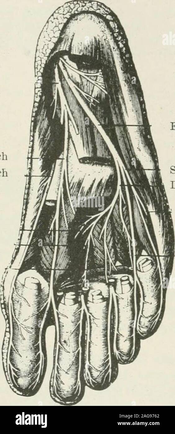 . Terapia medico-chirurgica. lato di thefibula. In un primo momento si trova nella sostanza del peroneus longus, thenin lo spazio che separa questo muscolo dal peroneus brevis ;poi passas attraverso il aponeurosis, diventando atthree sottocutanea o quattro dita larghezze sopra la punta del malleolo esterno,e alimenta la pelle dell'aspetto dorsale del piede. Nel suo corso il muscolo-nervosi cutanei muscularbranches dei materiali di consumo per la peroneus longus e il peroneus brevis. La sezione anteriore del nervo tibiale è il ramo interno della biforcazione delcarrello popliteo esterno. Come il muscolo-cutan Foto Stock