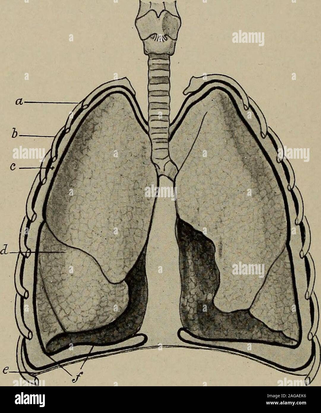 . Le malattie dei bambini. di fluido sierosa andflakes dei linfonodi. Una tale raccolta di fluido è denominato aserous ejjusion. Questa effusione può essere purulente in le caratte-ter, quando esso viene chiamato un eliminazione. Effusioni sierose sono meno comune nei bambini di inadults; al di sotto dei tre anni di età questa forma non è visto.Eliminazione, tuttavia, è molto più frequente in childhoodthan nella vita adulta. Pleurisy può comportare un lato del torace, quando essa istermed pleurisy unilaterale, o si può attaccare in entrambi i lati del torace, pleurisy bilaterali. Un sacculated pleurisy è il termine applicato ad un liquideffusion nel cavo pleurico whic Foto Stock