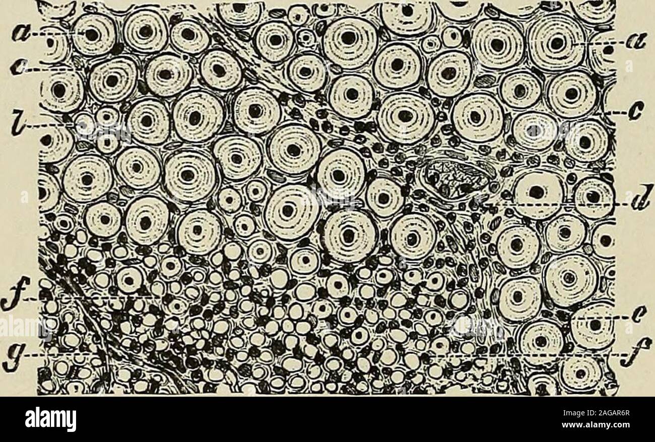 . Un trattato sulle malattie del sistema nervoso dei bambini : per medici e studenti. ganglio etweenthe-cella e theperipheral nervo-asparts in fibra di un neurone. Più di recente, researcheshave mostrato che la samepoison che spesso affectsthe nervo periferico-fibermay occasionalmente ganglio involvethe-cell. Stieglitzhas dimostrato questo per essere thecase in avvelenamento da piombo. Hefound un distinto poliomy-elitis in animali compelledto inalare i sali di piombo; eppure non possiamo negare, in vista di vari post-mortemfindings, che nell uomo il piombo è incline a causare malattia dei nervi periferici.Oppenheim ha descritto una leggera chang Foto Stock