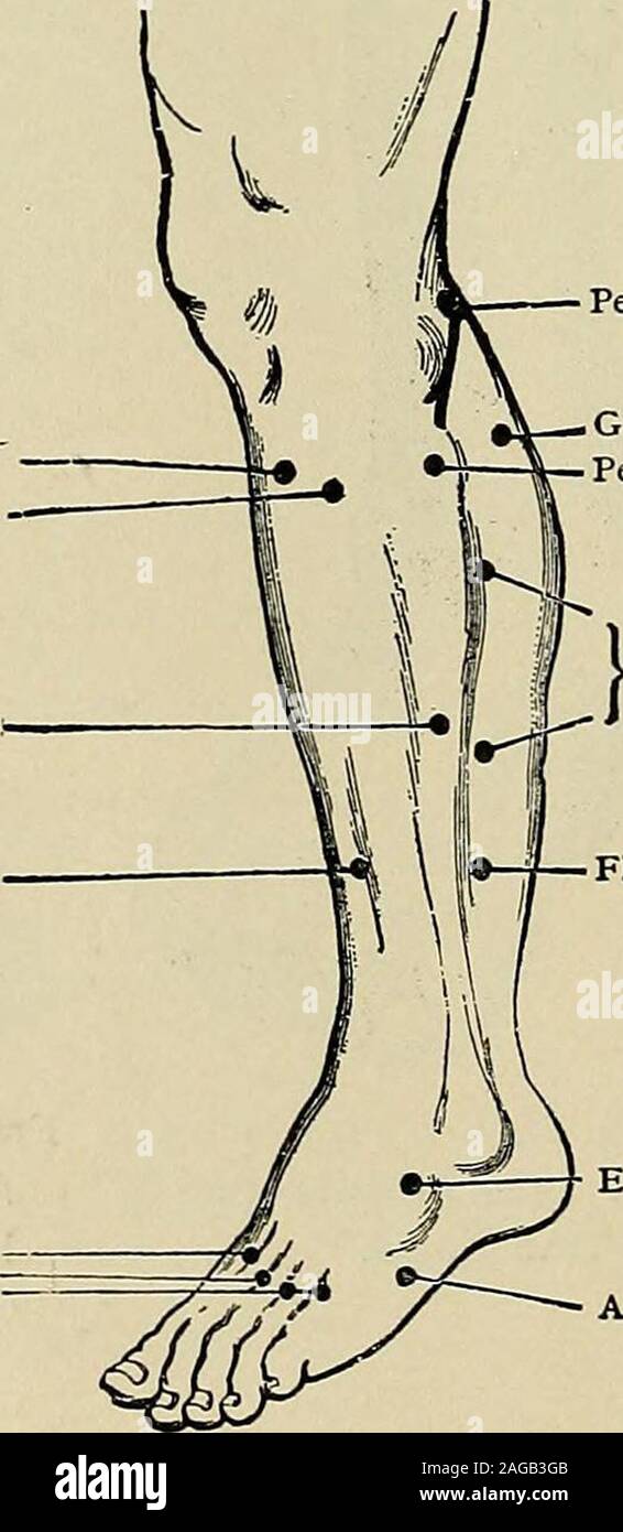 . Un trattato sulle malattie del sistema nervoso dei bambini : per medici e studenti. Fig. 27. - Pes Equinus ofEight anni di durata. Tibiale AnticusExtensor cifra. Commun. Longus. Peroneus Brevis estensore Hallucis Longus Interossei dorsali. Nervo peroneo gastrocnemio (Testa esterna).Peroneus Longus Hallucis flessori estensori Longus cifra. Comm. Brev.Abductor Digiti Minimi Fig. 28.-punti motori. (Erb.) INTRODUZIONE-METODI DI ESAME.i muscoli della schiena e del tronco. 33 Malattie in nome di sintomi normali di innervati rappresentato che il muscolo è muscolo. Funzione. Azione carente. Da in comunemente in-coinvolta Foto Stock