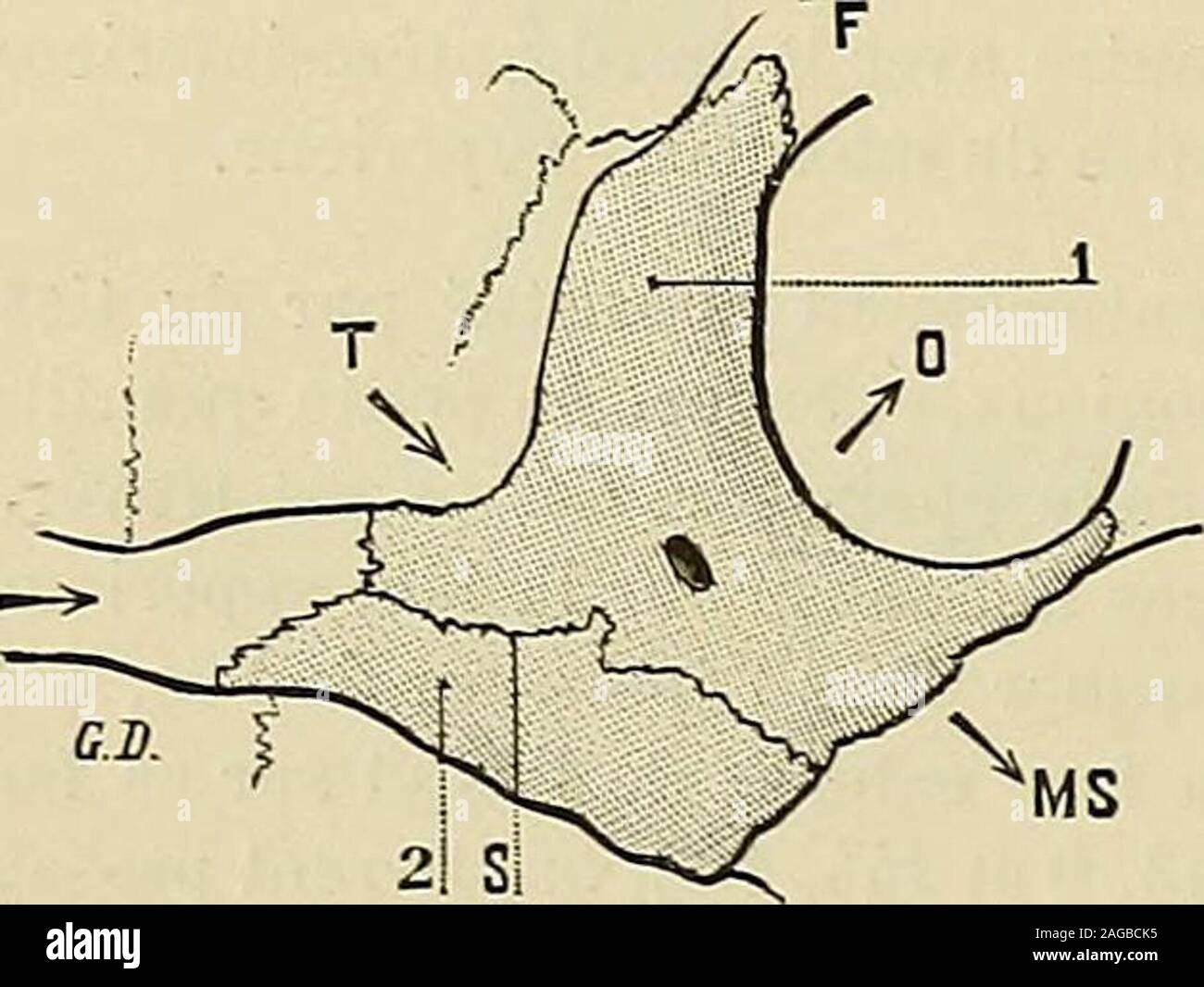 . Traité d'anatomie humaine : anatomie descrittivo, histologie, développement. Fig. 14b.Costituzione théorique de los malairc. 1. prêmalaire. - 2, poslmalaire. - 3. livpomalaîre. -O. orbite. - T. fosse temporale. - F, frontale. - MS,maxillaire supérieur. - SS, la sutura des pièces malaires.. Foto Stock