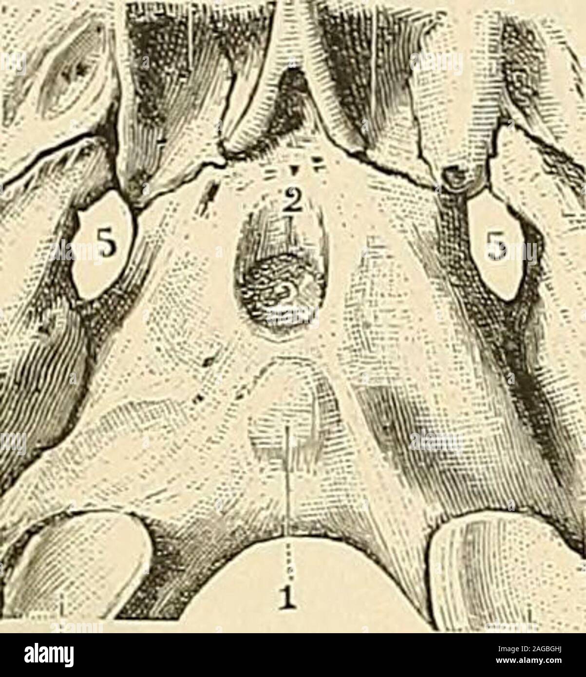 . Traité d'anatomie humaine : anatomie descrittivo, histologie, développement. rliculant avec le bord libre de lapophyse orbitaire de losmalaire. - 33, la sutura sphéno-temporale. - 34, corps du sphénoïde. canaux ethmoidaux ou condotti orbitaires internes, le trou, optique, la fentesphénoïdale et Y orifizio du sphénoïdal sinusale. B. Zona jugulaire. - La zona moyenne ou jugulaire est constituée : a. Sur la ligne médiane, par la superficie basilaire de loccipital, où les viennentsinsérer muscoli grand droit antérieur et petit droit antérieur de la Tête, etsur laquelle nous remarquons, outre les rugosités Foto Stock