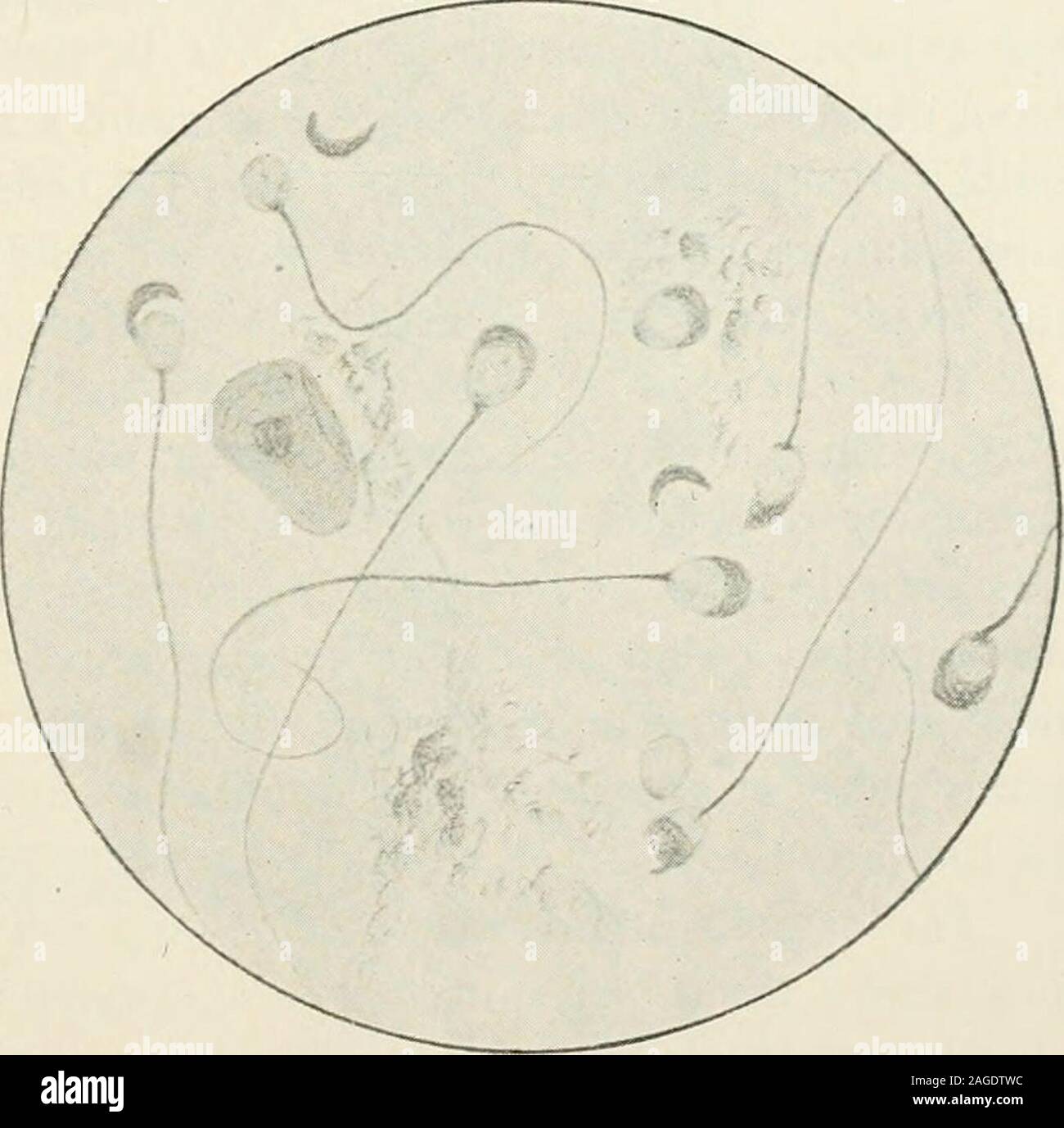 . Journal of applied microscopia e metodi di laboratorio. atic fluidi sia grigio whiteand ratti sono stati studiati, andno marcata differenza è stata trovata toexist tra queste cellule. La testa e la coda di questa cella stainswell, il bordo concavo di colorazione con la testa leggermente più profonda thanits corpo. Le misurazioni werefound da : la Fig. 9.-Ratti bianco. Lunghezza totale,Lunghezza, testa,Lunghezza coda. 0,225 a U.288 mm., o per 0.0087 0.0092 in.0,012 a 0,016 mm., o 0,0004 a 0,0006 in.0,209 a 0,222 mm., o 0,0081 a 0.0086 in. Lo spermatozoo del porcellino d'india (Fig. 10) differisce ampiamente fromany altri stati della serie.it Foto Stock