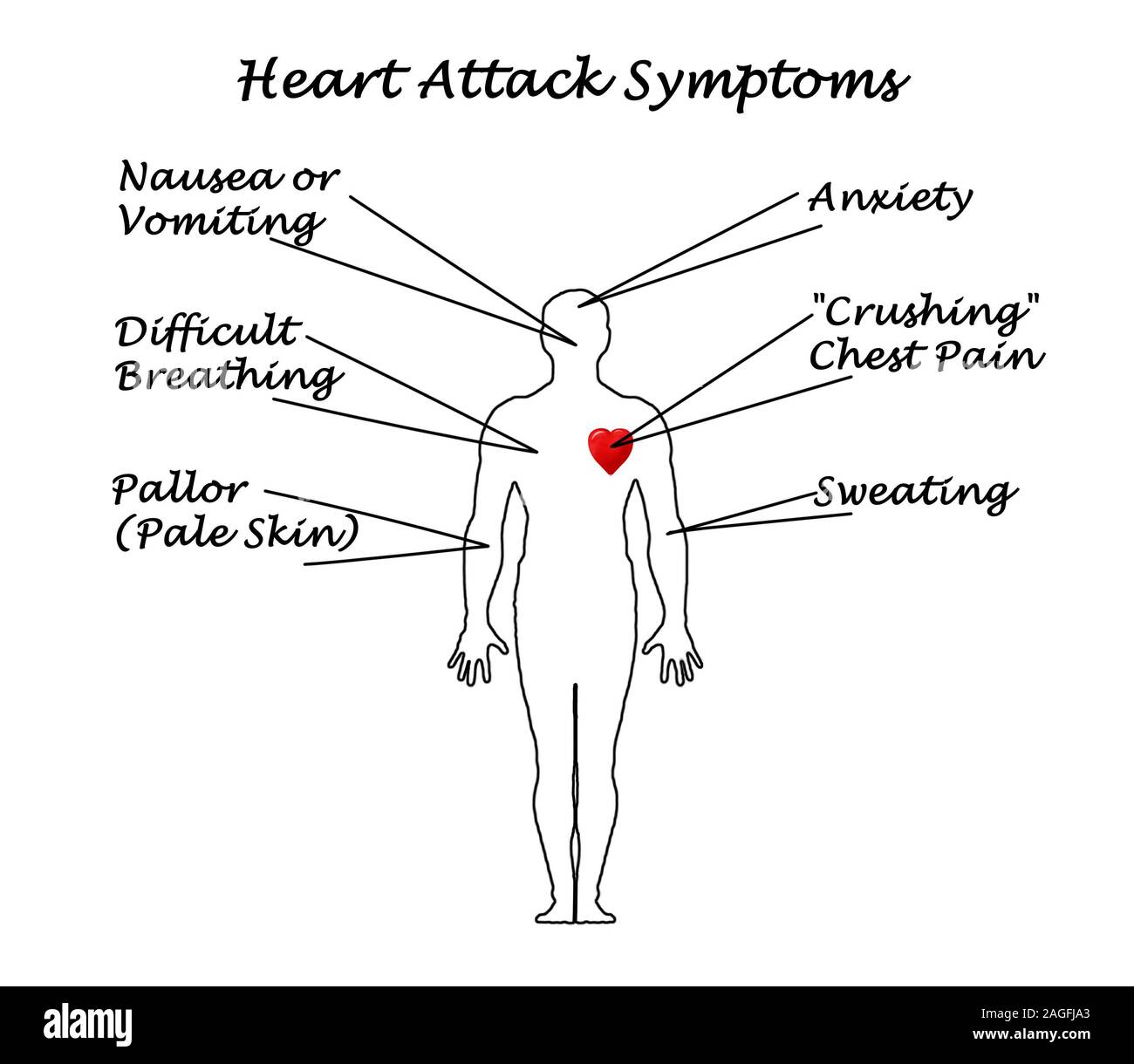 Attacco di cuore i sintomi Foto Stock