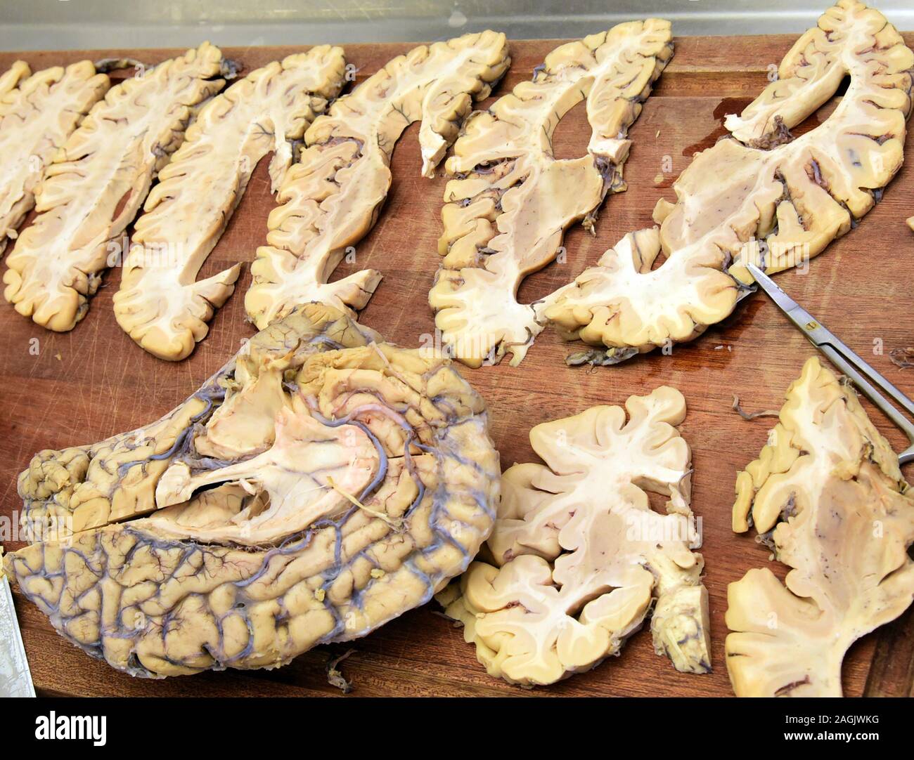 13 dicembre 2019, Sassonia, Lipsia: In una sala di dissezione presso l'Istituto di Anatomia della Facoltà di Medicina dell'Università di Lipsia, immagini di sezione del cervello umano sono visualizzati. In un seminario sulla neuroanatomia, variazioni patologiche del cervello nella malattia di Alzheimer può essere identificato, tra le altre cose. Il centro di formazione per attualmente circa 3000 studenti di medicina umana e dentaria con i suoi 48 istituti e ambulatori è il leader in Germania in termini di breve durata degli studi e il tasso di successo in stato di esame. Foto: Waltraud Grubitzsch/dpa-Zentralbild/ZB Foto Stock