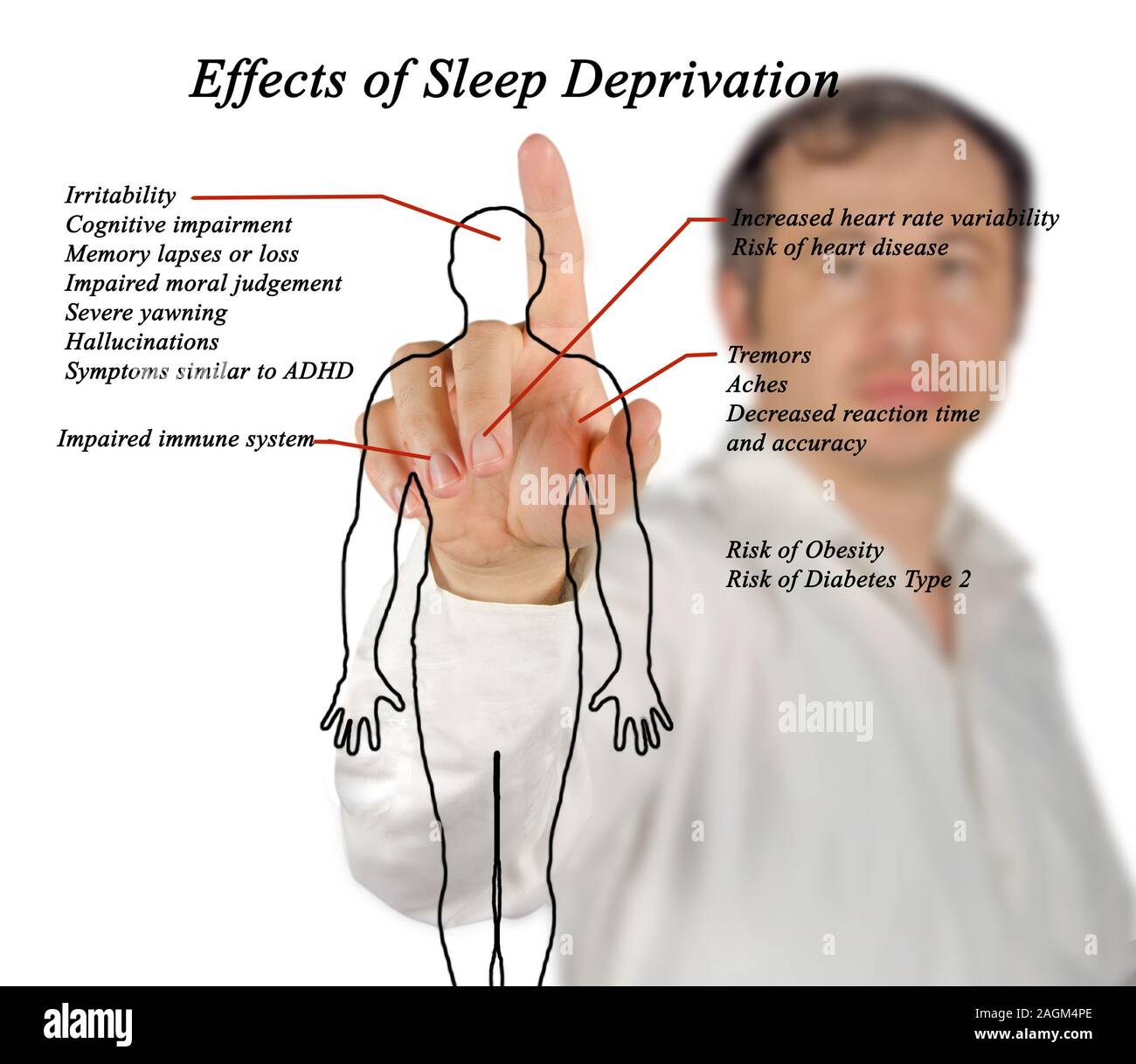 Gli effetti della privazione del sonno Foto Stock